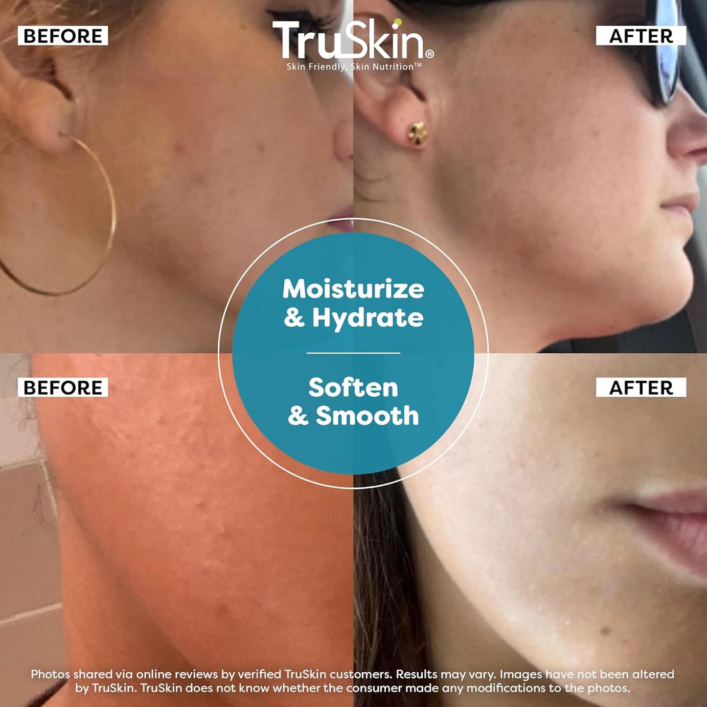 TruSkin Hyaluronic Acid Serum for Face + 7 Ultra Hydrating Ingredients – Best Face Serum for Moisturizing, Visibly Plumping Skin & Smoothing the Look of Fine Lines, 1 fl oz