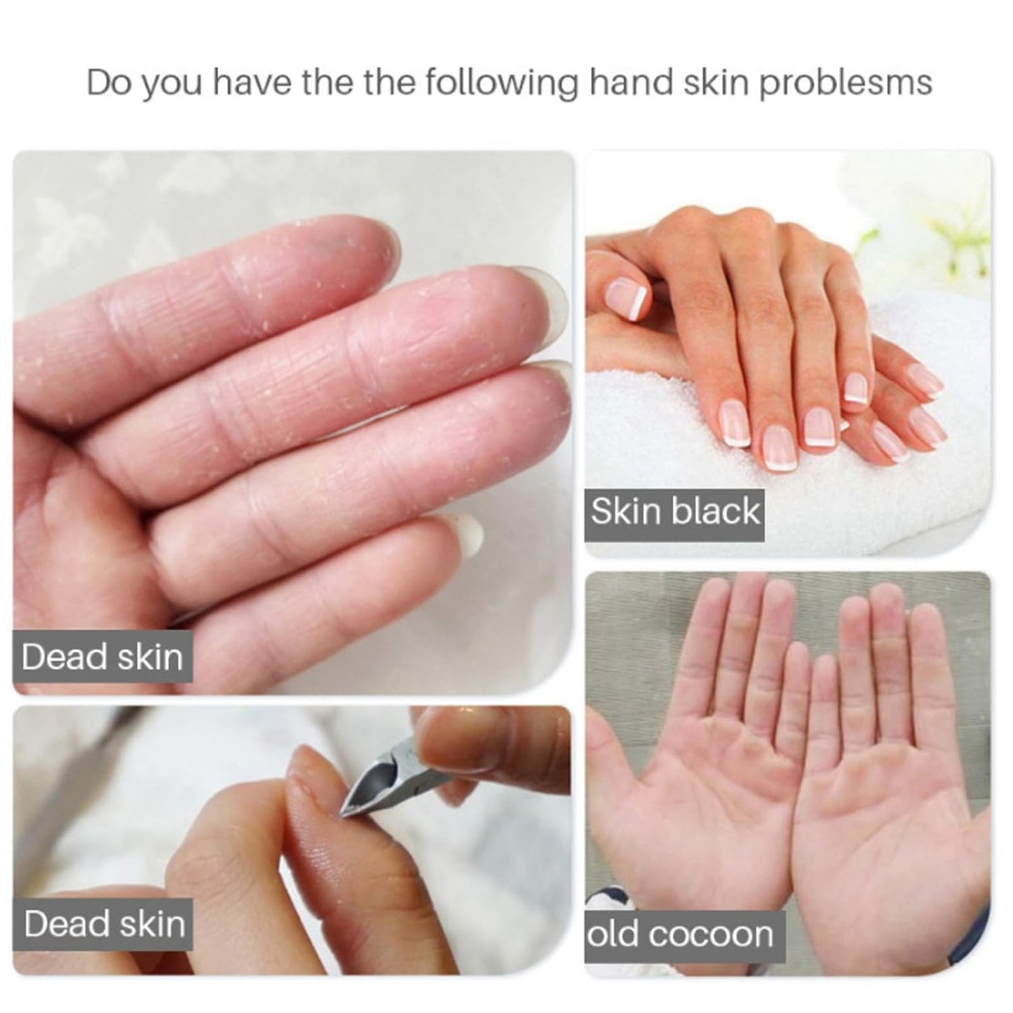 VolksRose Moisturizing Hand Mask Gloves for Dry Cracked Hands, Overnight Repair Treatment - Intensive Hydration Hand Masks with Lavender, 5 Pairs - Spa Care for Extremely Dry, Rough Skin