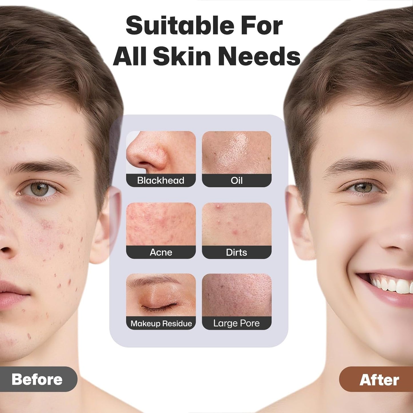 PRITECH Facial Cleansing Brush, Rechargeable Silicone Face Scrubber with Heat Massage End, Vibrating Exfoliator Scrubber for Deep Cleaning, Waterproof Face Brush for Women and Men (Black)