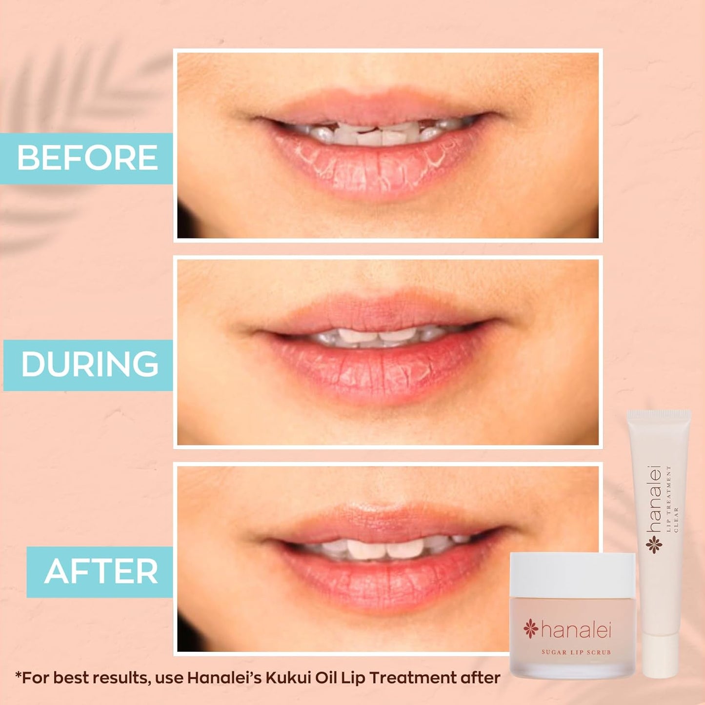 Hanalei Vegan Sugar Lip Scrub Exfoliator - Hawaiian Cane Sugar, Kukui Oil & Shea Butter for Smooth, Hydrated Lips - Natural, Cruelty-Free Lip Care, Removes Dry Skin, Moisturizes & Softens (22g)