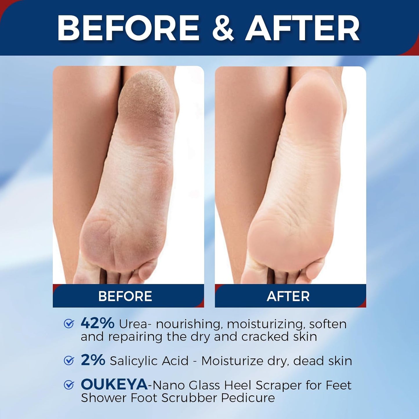 OUKEYA Urea Cream 42 Percent with 2% Salicylic Acid Tube, Urea Cream 40 Percent For Feet Maximum Strength, with Foot Callus Remover, Nano Glass Foot File