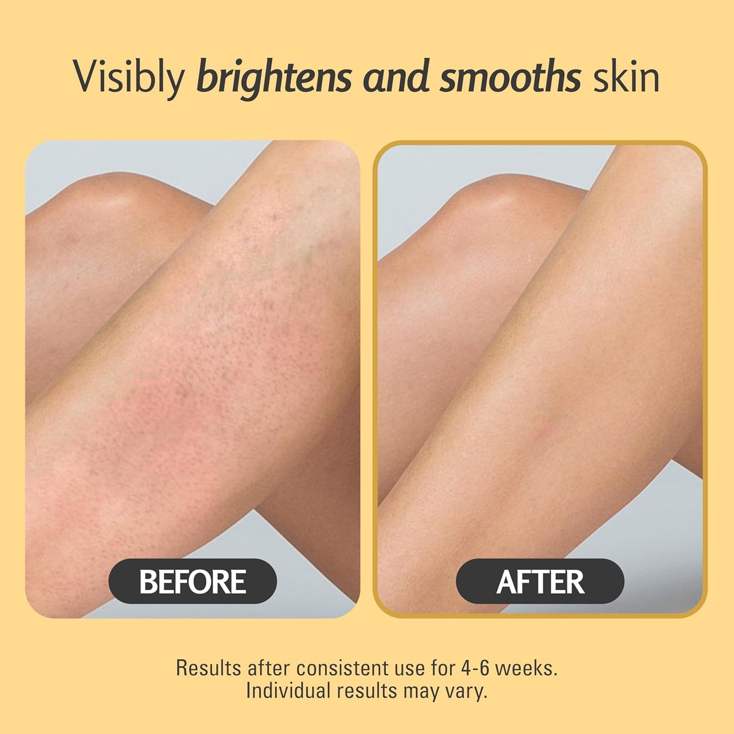 Exfoliating Turmeric Scrub and Skin Exfoliator with Collagen and Coconut Oil, Gently Exfoliates Face, Body, Hands, and Feet, Moisturizing Skincare, 16 oz by M3 Naturals