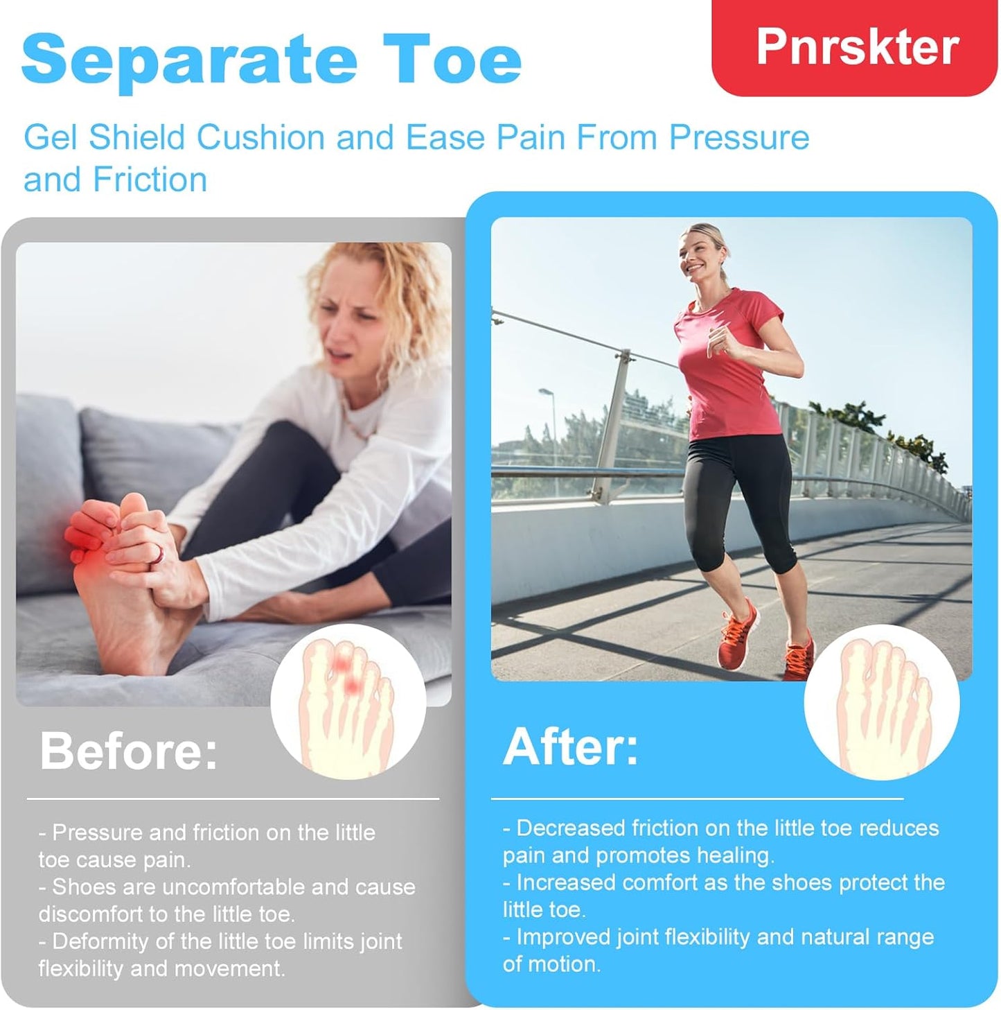 Pnrskter Gel Toe Protectors Caps - Open Toe Sleeves(20pcs-Medium), Toe Covers Toe Tubes for Blisters, Corns, Calluses, Hammer Toes, Rubbing, and Ingrown Toenails