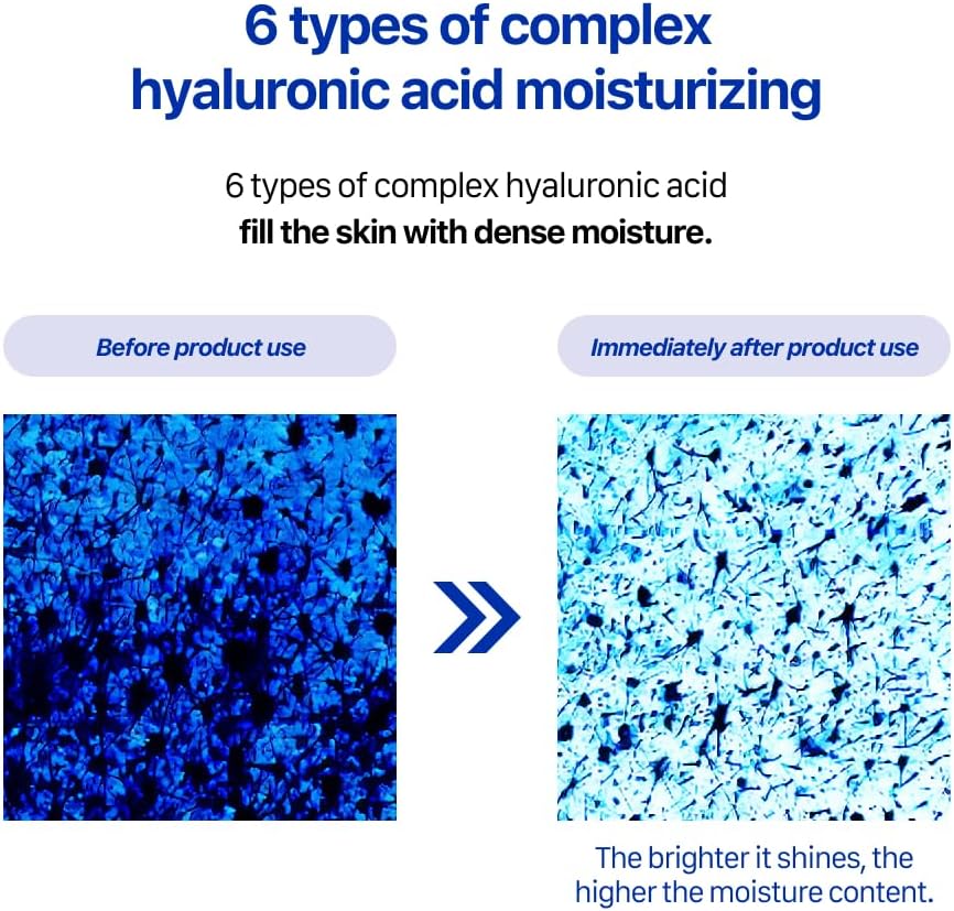 Real Barrier Extreme Essence Toner Light 6.76 Fl Oz | Hyaluronic Acid Panthenol Face Moisturizer for Sensitive Dry Skin | Soothing & Hydrating Moisturizing Toner for Face | Korean Skin Care