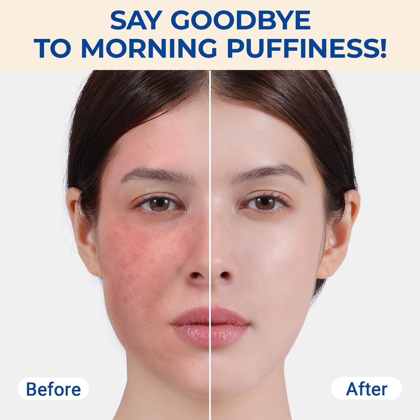 MORGLES Ice Roller for Face, Professional Face Roller Cryotherapy Tool to Reduce Puffiness, Redness & Headaches, Tighten Skin and Improve Lymphatic Drainage with Ergonomic Handle (Pink)