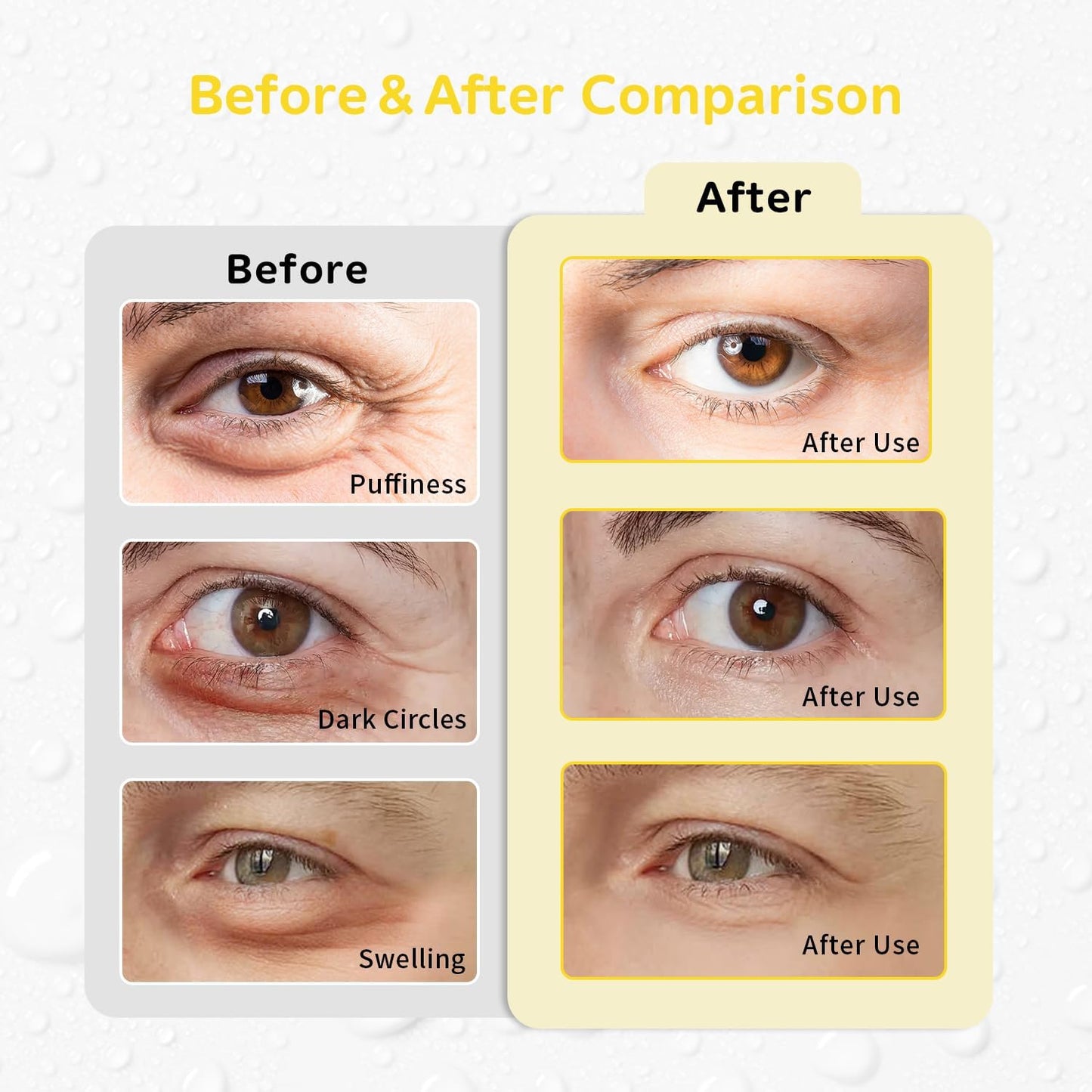 4PCS Gel Eye Ice Pack Set, Cold & Hot Compress, Reusable Cooling Gel Pads for Strain Relief, Swelling, Dark Circles, Redness, Puffy Eyes, Surgery Recovery(4 Yellow flowers)