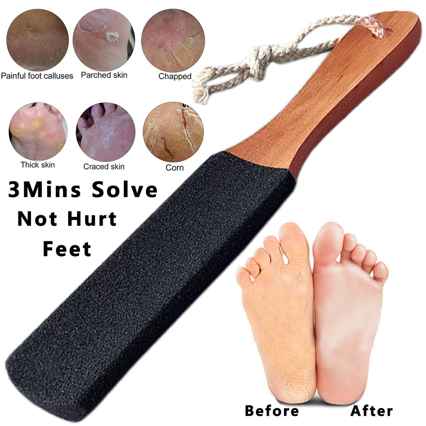 Foot Scrubber Pedicure Foot File Pumice Stone,Professional Pedicure Supplies Callus Remove Cracked Heels,Dead Skin,Corn,Scraper File Foot Care Foot Rasp Massage Brush Tools Kit for Men/Women