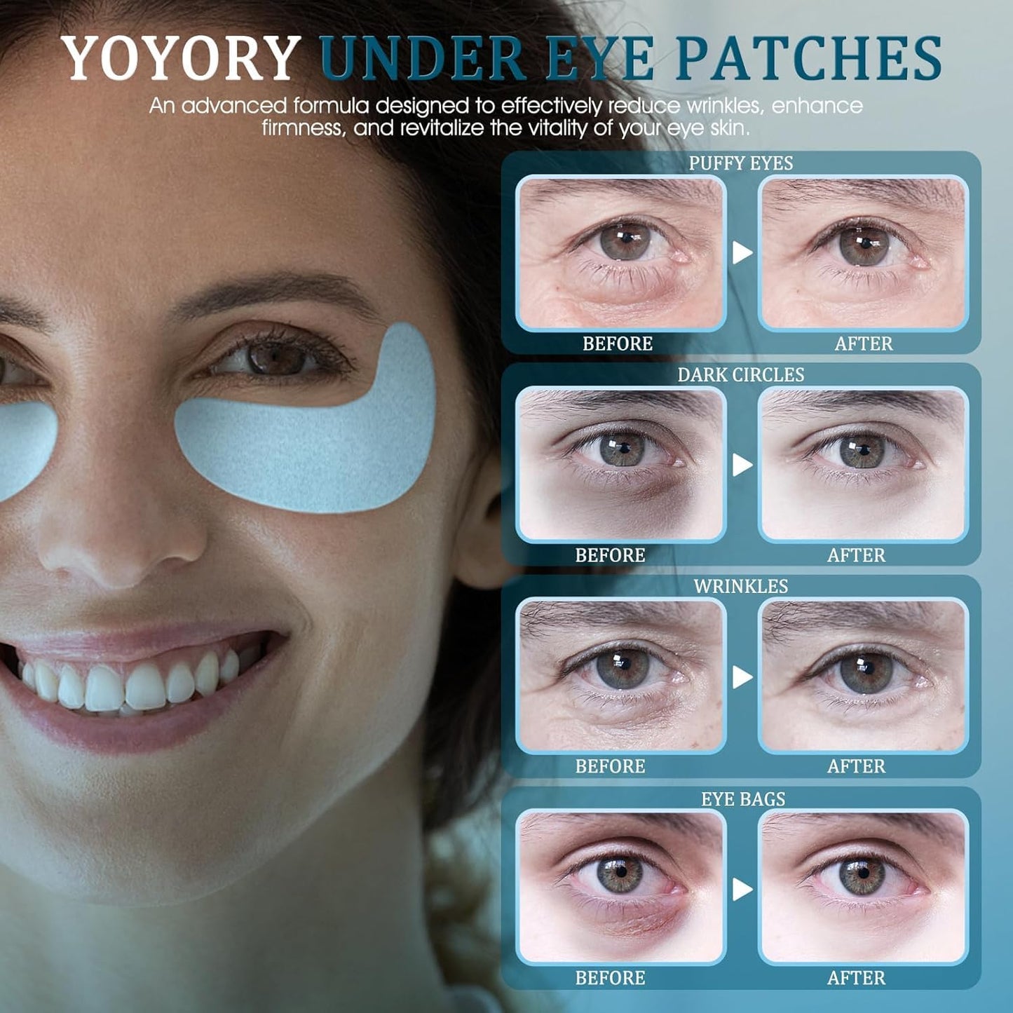 Under Eye Patches Masks - for Eye bags with Collagen and Hyaluronic Acid, Dark Circles,and Fine Lines, puffiness Smoothing Skin Care Treatment for Women and Men, (30 Pcs) white