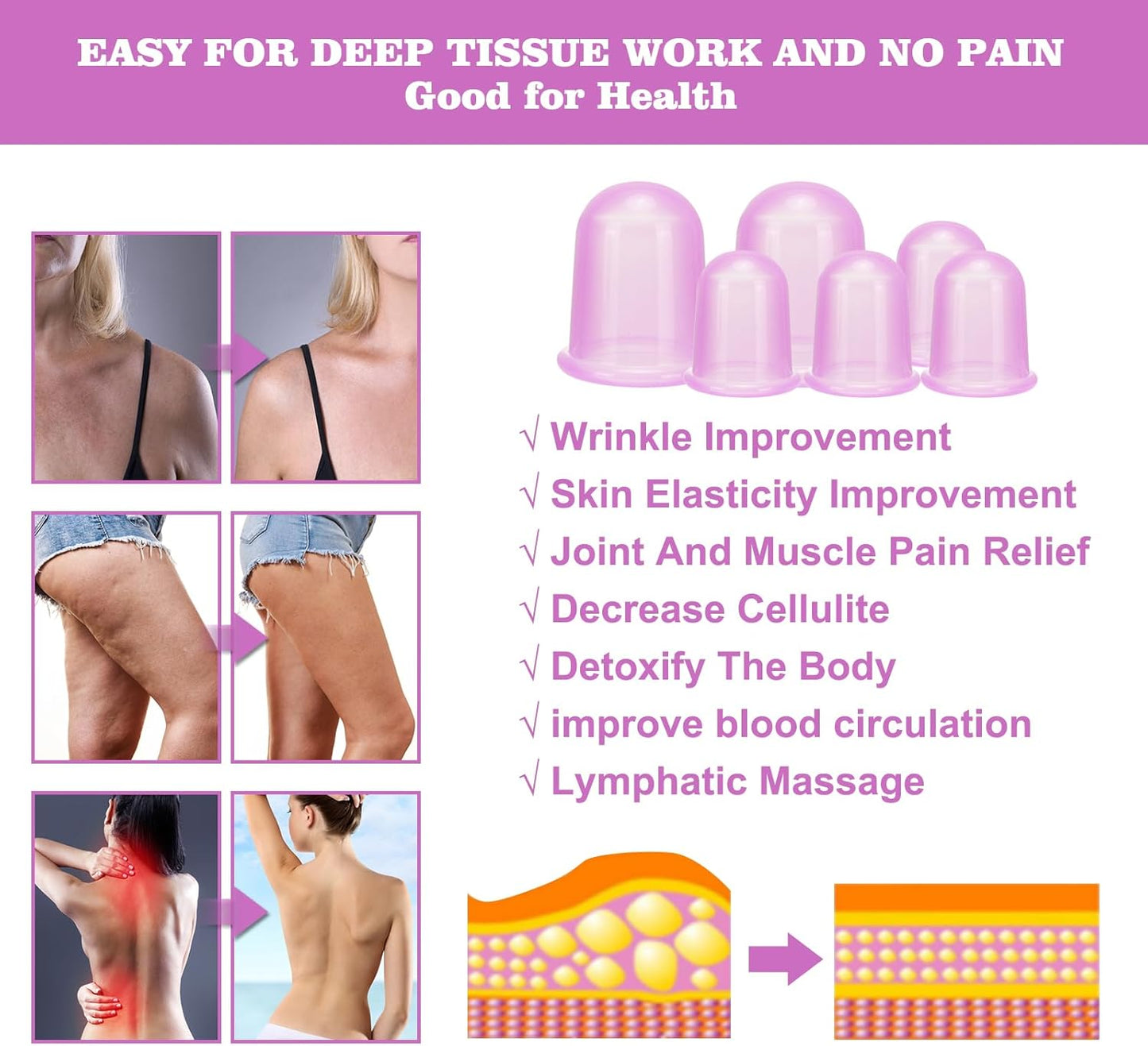 Silicone Cupping Therapy Set - Cupping Kit for Massage Therapy - Cellulite Remover Cupping Set - Anti Cellulite Cup Massager, Vacuum Suction Massage Cups for Cellulite Reduction