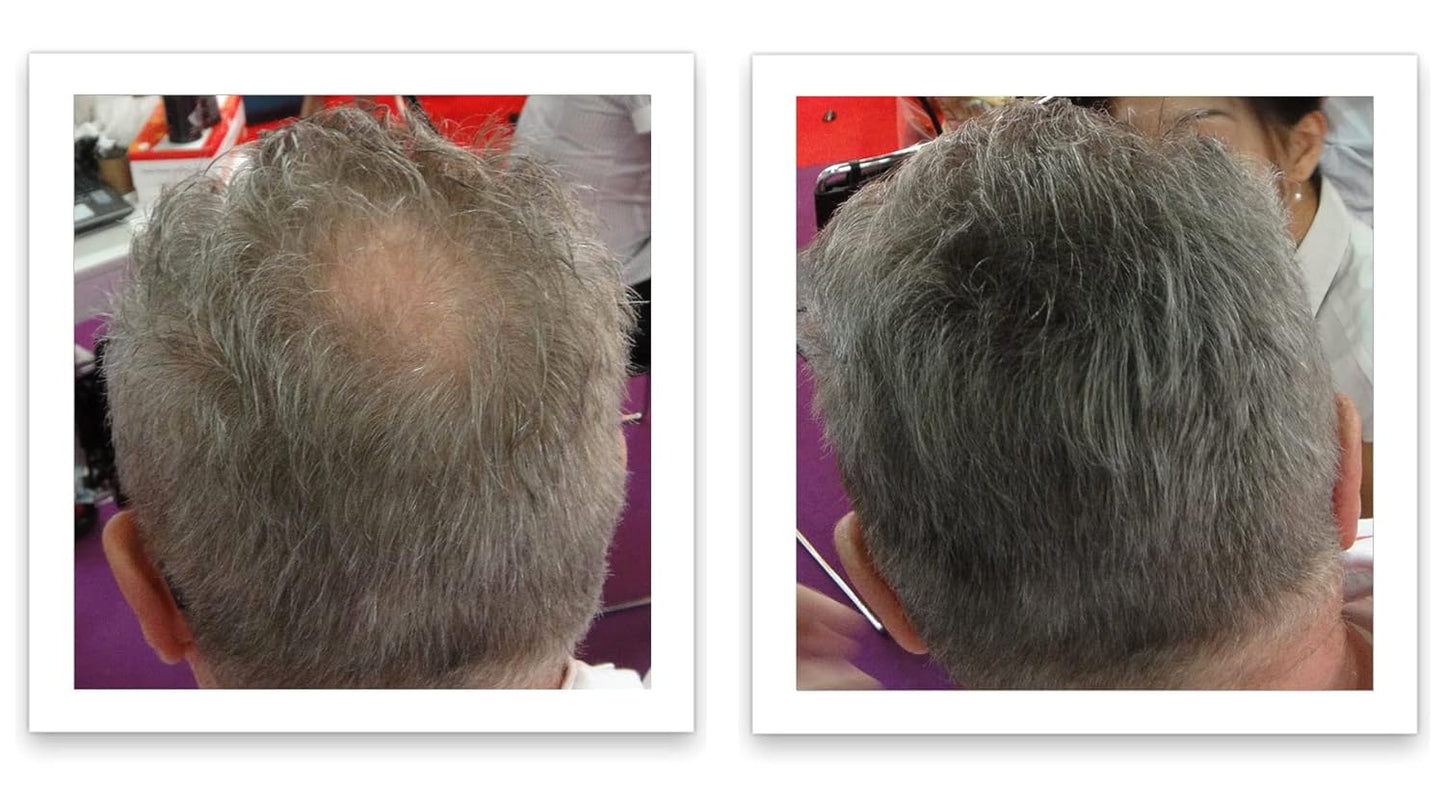 Caboki Hair Building Fiber + Built-In Spray Applicator (30-50 days supply). Salt & Pepper Light