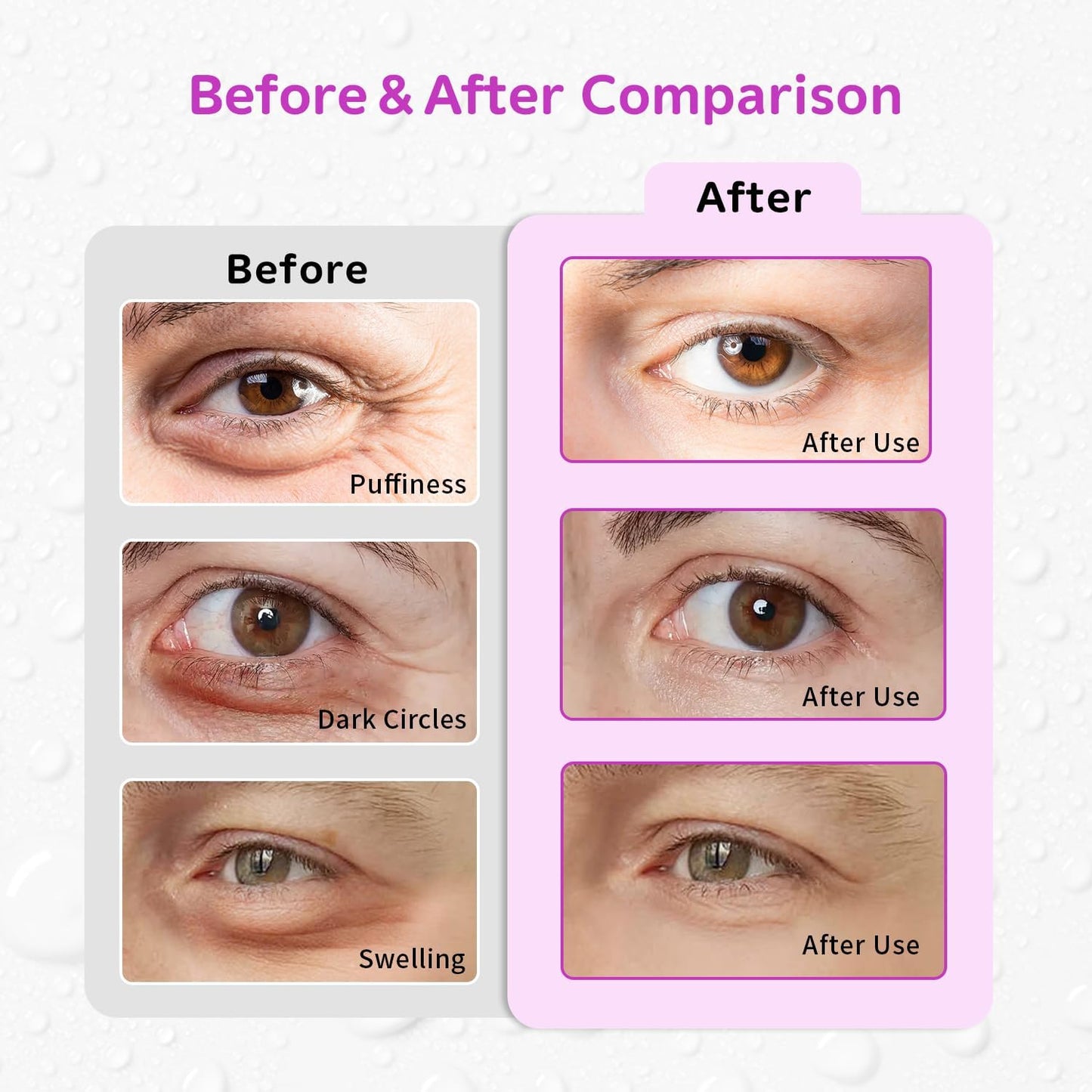 4PCS Gel Eye Ice Pack Set, Cold & Hot Compress, Reusable Cooling Gel Pads for Strain Relief, Relaxation, SPA and Sleep (4 Purple Flowers-2)