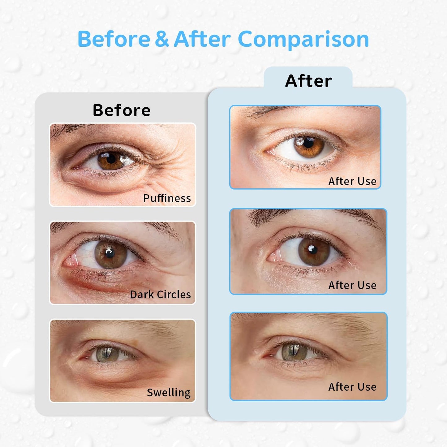 4PCS Gel Eye Ice Pack Set, Cold & Hot Compress, Reusable Cooling Gel Pads for Strain Relief, Swelling, Dark Circles, Redness, Puffy Eyes, Surgery Recovery (4 Blue flowers)