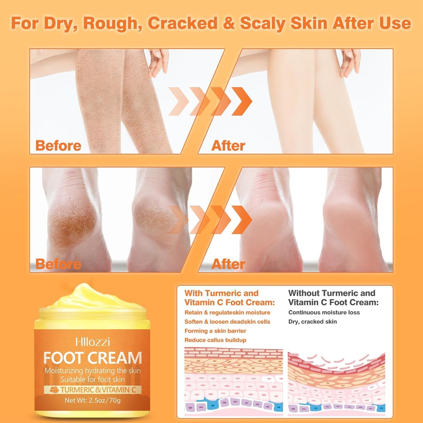 Turmeric & Vitamin C Foot Cream for Dry Cracked Heels and Feet, Ultra-Hydrating Softening Foot Cream, Moisturizes for Healthy Feet, 2.5 oz