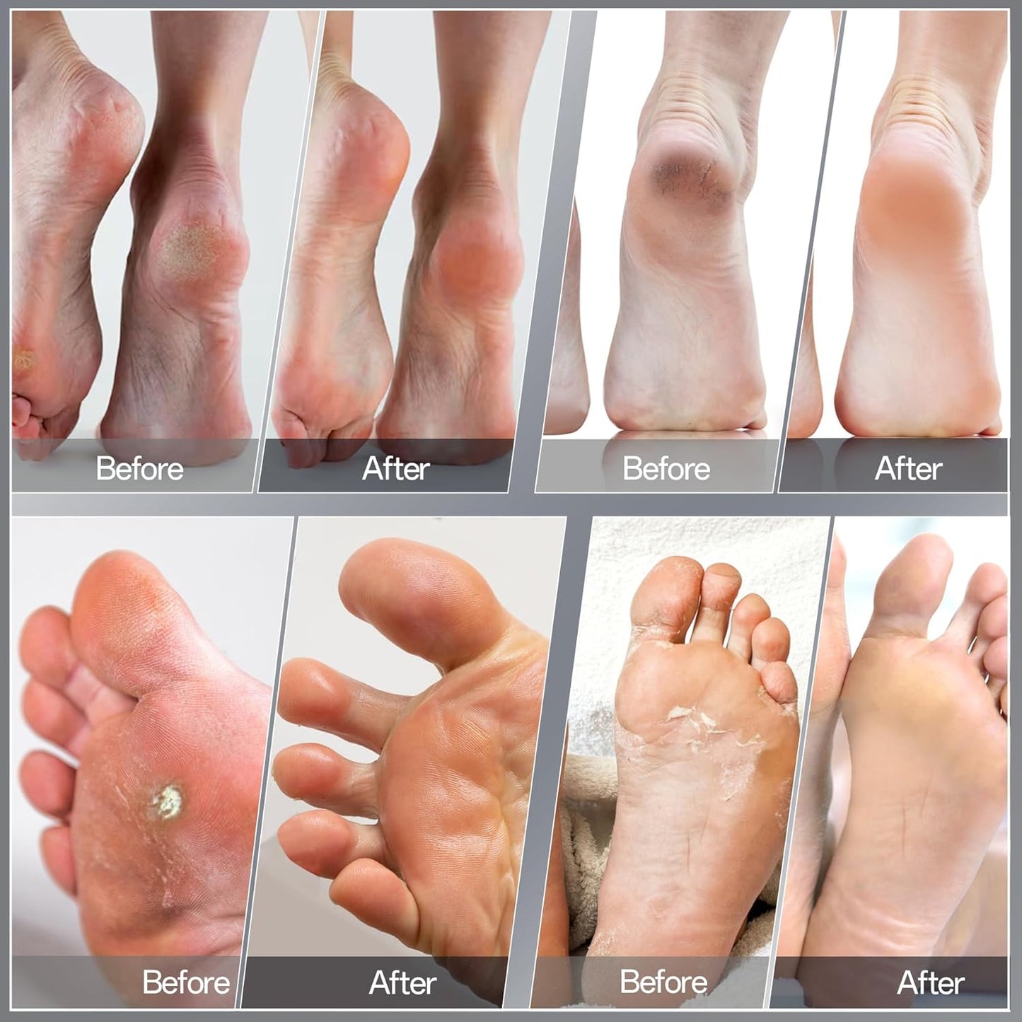 New Version Electric Foot File - Electric Callus Remover for feet,Adjustable Speed Foot File with 60 Pcs Sandpaper Discs for Men & Women Dead Dry Calluses and Cracked Heels,Professional Pedicure Tool