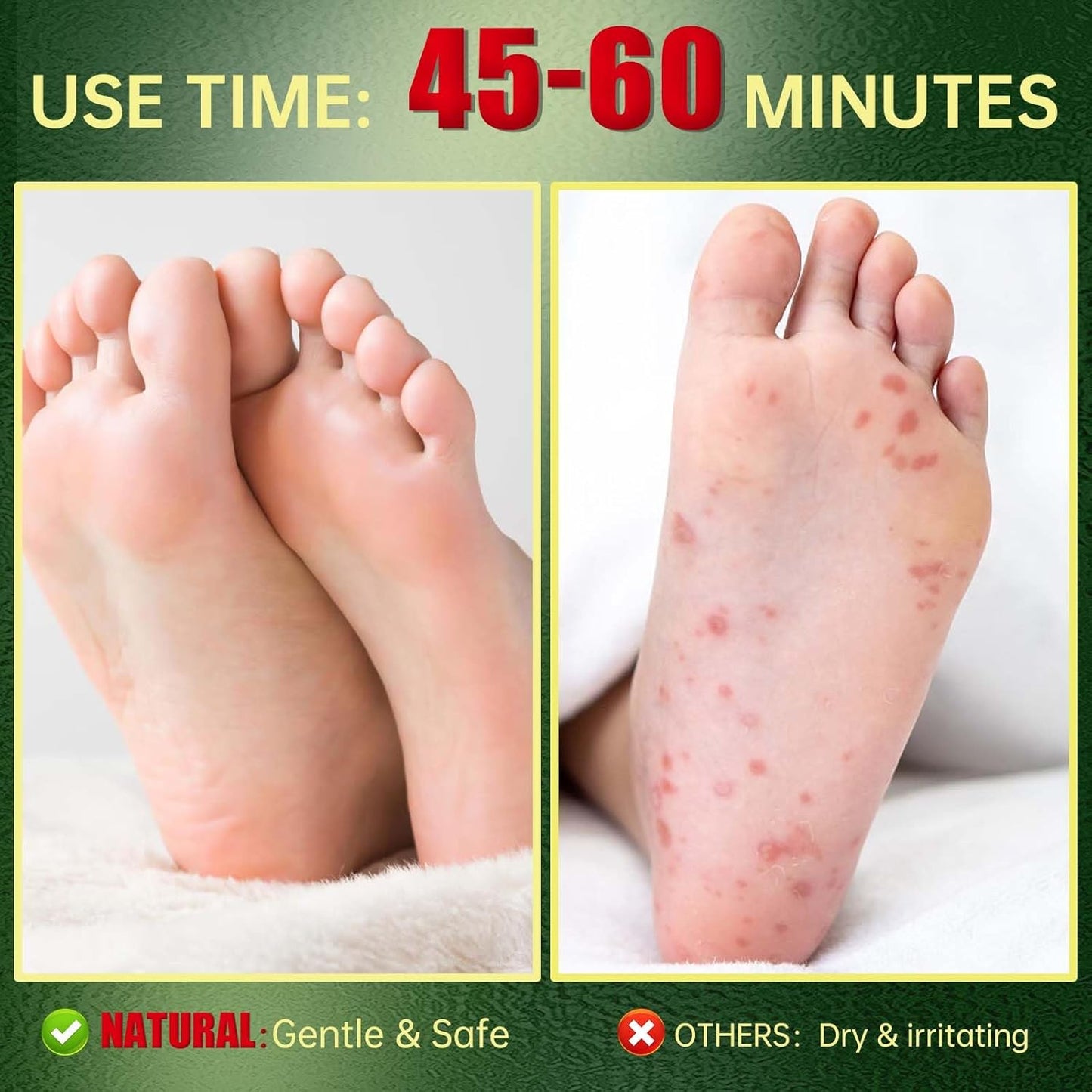 Foot Peeling Mask, Natural Exfoliating Foot Mask, Dead Skin Callus Remover Repair Heels, Hydrating Foot Care for Dry Cracked Feet (6 Pack)