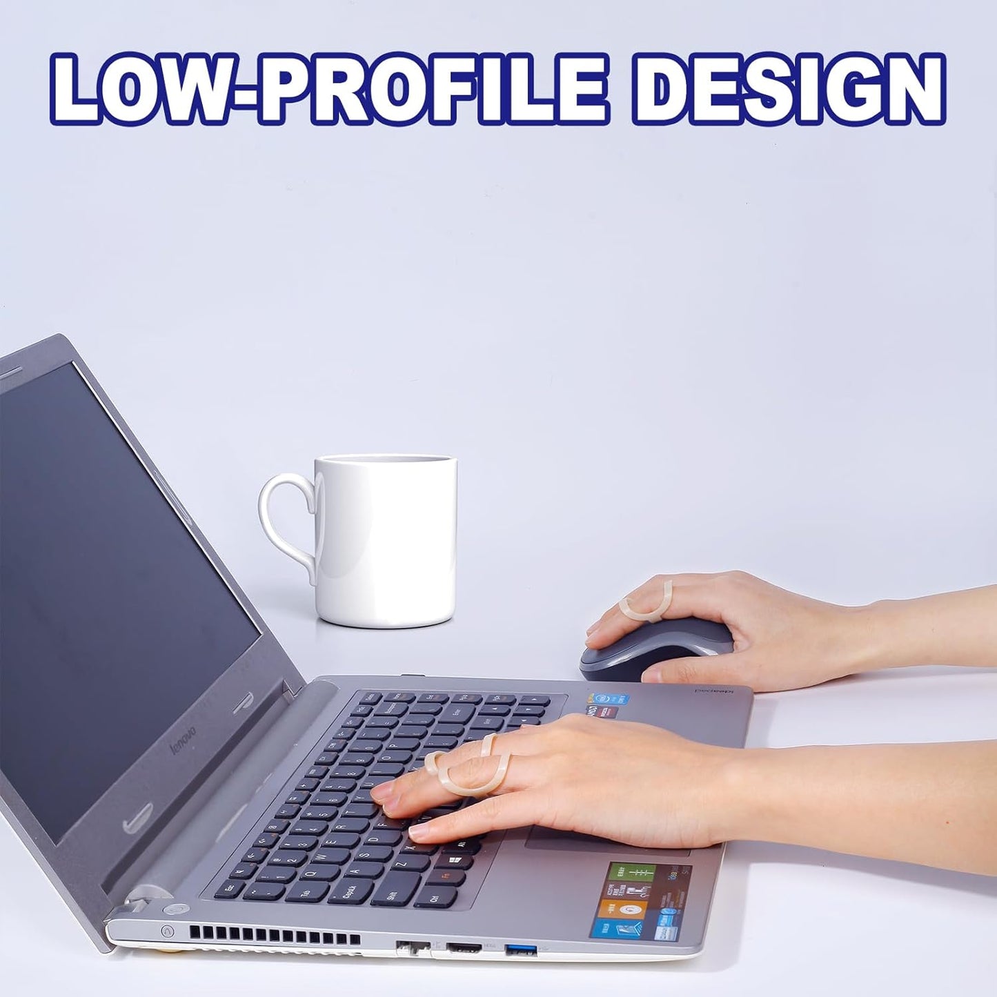 8Pcs Oval Finger Splints & Click-Lock Adjustment Kit, 4 Graduated Finger Ring Splint & 4 Splint Adjustment, Finger Braces for Arthritis, Mallet, Straightening, Support (Size 4-7)