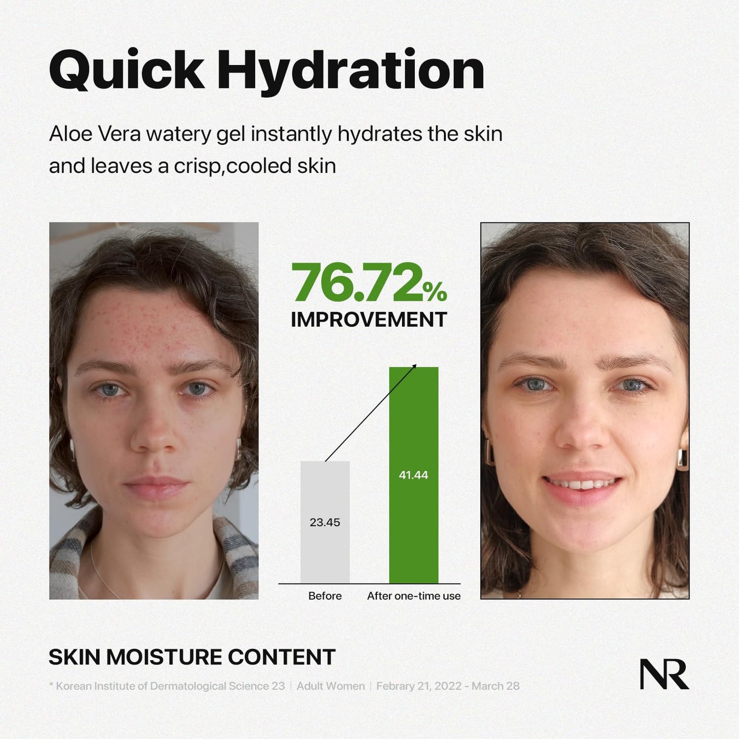 Nature Republic MILD & MOISTURE ALOE VERA WATERY GEL (TUBE) Quick Hydration & fast absorbing non-sticky texture, aftersun cooling pack, Moisturizing Face Skin & Hair,korean skin care All Skin Types