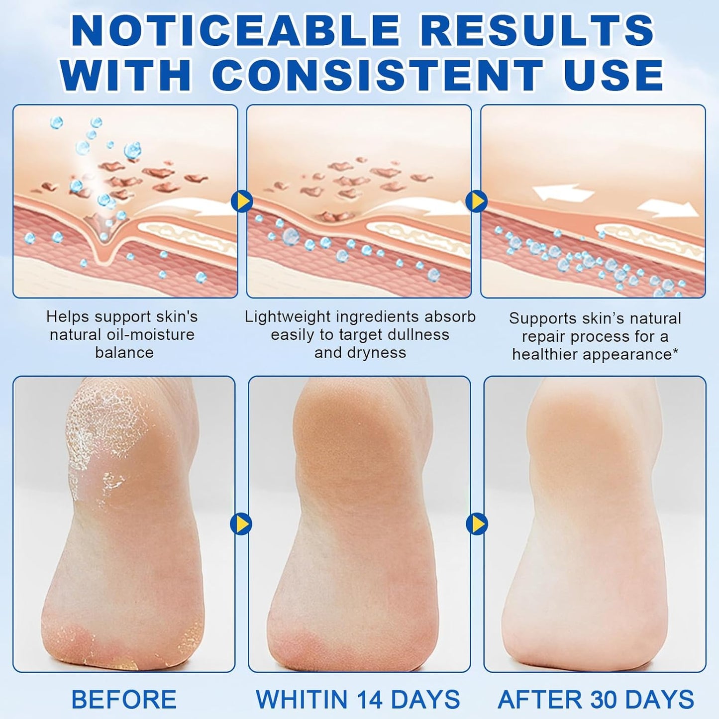 Urea Foot Cream with Salicylic Acid – Heel Stick for Cracked Feet, Repairs Dry Rough Heels Fast, Intensive Moisturizer for Dead Skin, Hydrating Heel Balm with Urea for Smooth -Looking Feet