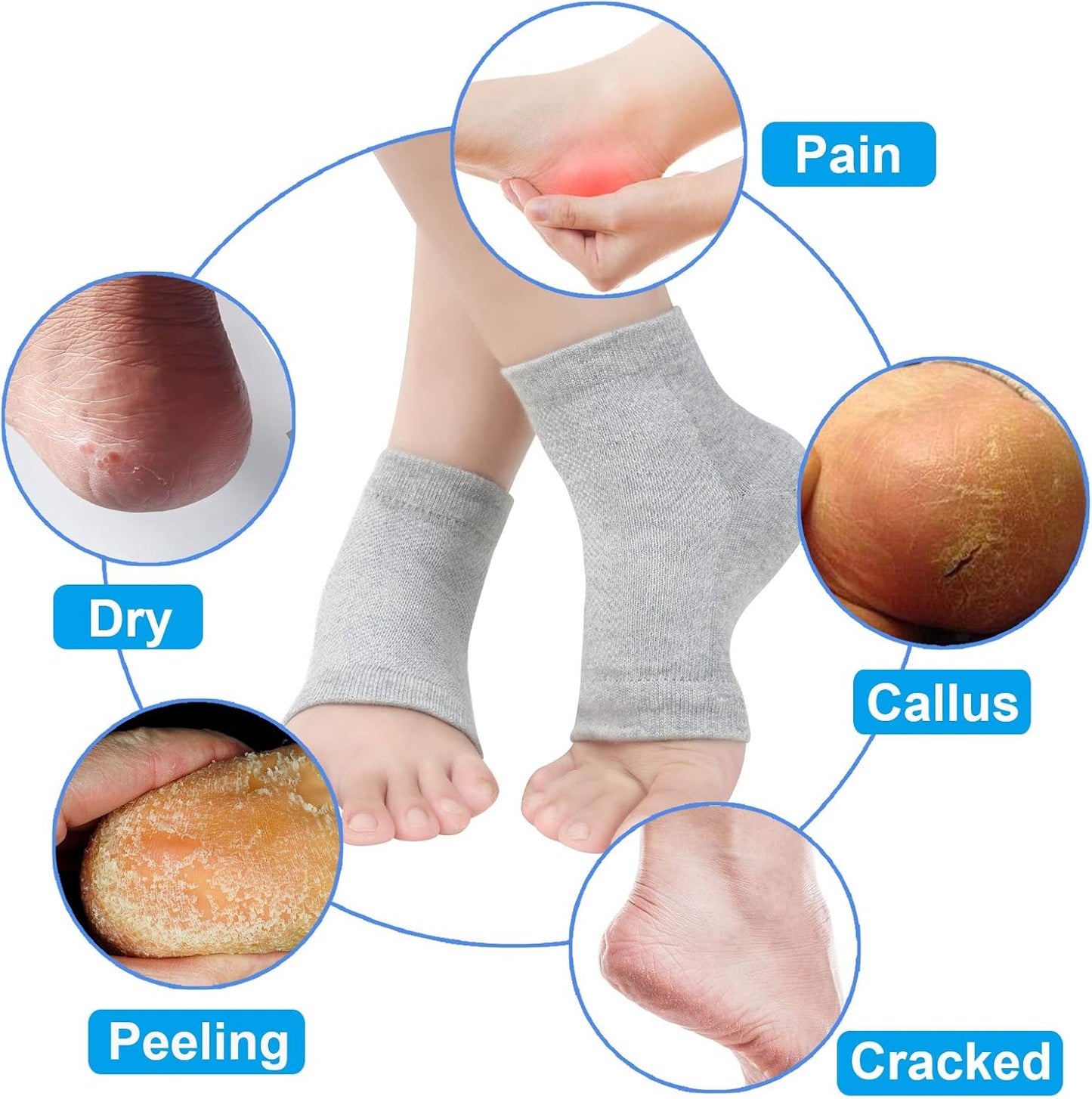 Vented Moisturizing Gel Heel Socks, 3 Pairs Toeless Spa Sock for Foot Care Treatment, Cracked Heels, Dry Feet, Foot Calluses (Grey)