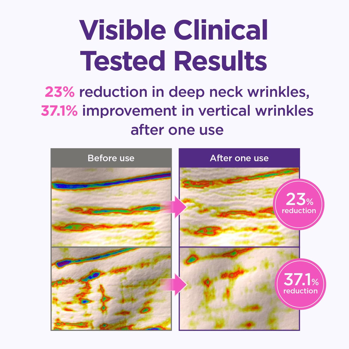 CKD Gua Sha Neck Cream Filltocshot [Refill] - Advanced Anti-Aging Neck Firming Cream with Massage Roller. Visibly Reduces Wrinkles, Lifts & Tightens Sagging Skin, Boosts Elasticity, Korean Skincare.