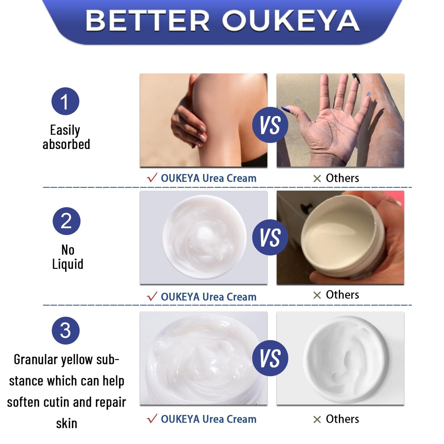 OUKEYA Urea Cream 42% plus Salicylic Acid 2% Intensive Repair Treatment for Cracked Skin on Hands, Heels, Elbows, and Lips - Relief for Dry Feet - Enhanced Pump Dispenser Packaging - Gross wt 8.03 OZ