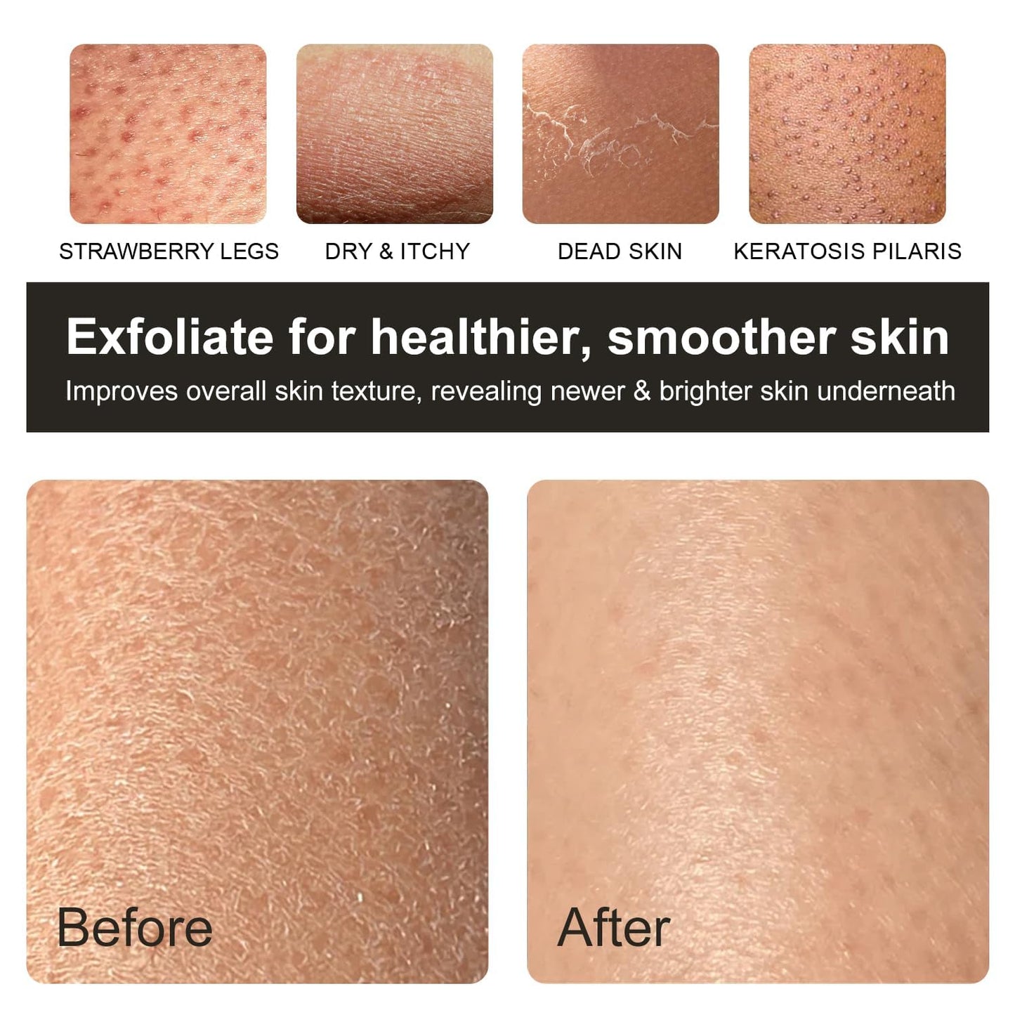 Korean Exfoliating Mitt - Exfoliating Gloves 3 Pack - Exfoliating Body Scrubber, Viscose Fiber Body Scrub Gloves, Dead Skin Remover for Smoother Skin, Self-Tan Prep & Removal