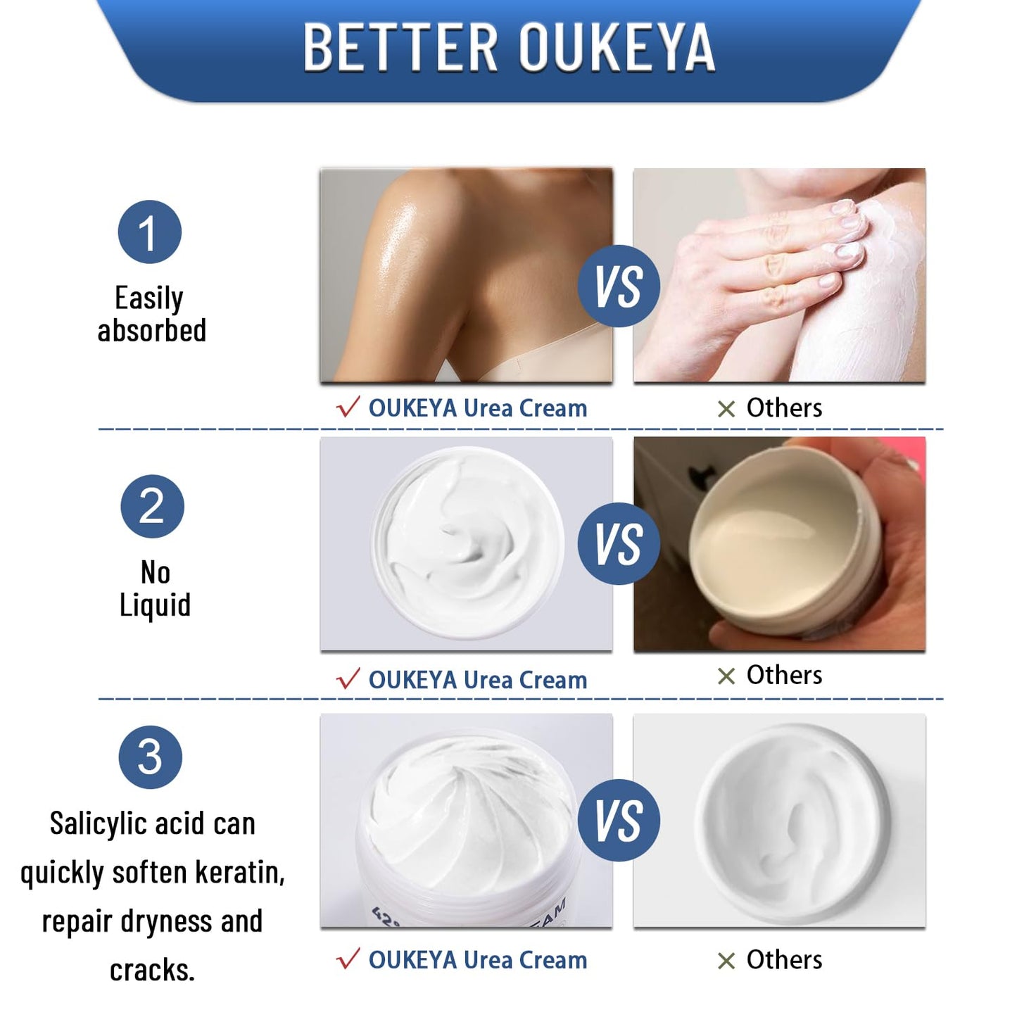 OUKEYA Urea Cream 42% plus Salicylic Acid 2% Net 5.29 Oz for Dry Cracked Feet,Heels,Knees,Elbows,Hands Repair Treatment Moisturizes and Removes Corns,Calluses,Dead Skin,and Softens Toenails Pack of 2