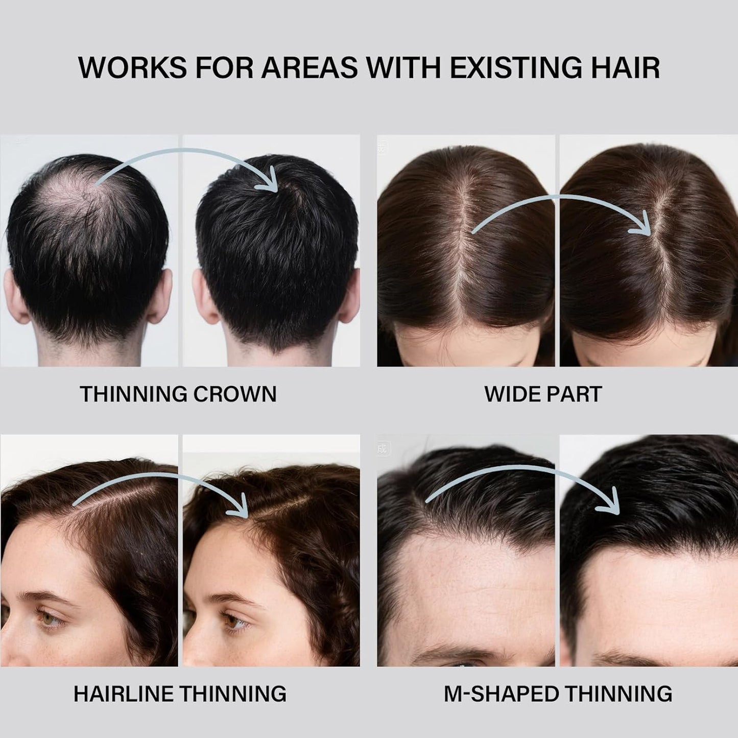 Hair Building Fibers for Thinning Hair for Men Women, 2-in-1 Kit- Enhancements Barber Spray, Thicker Fuller Hair Beard & Hairlines Instantly with Spray Applicator Nozzle, Natural Formula (Dark Brown)