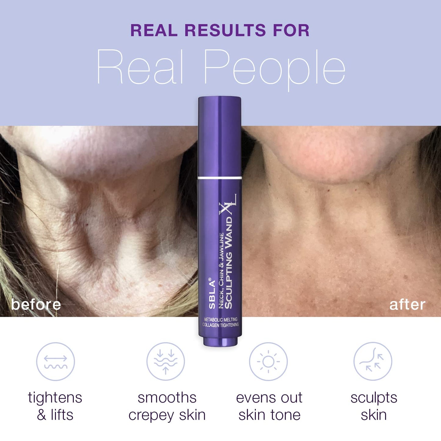 SBLA Neck, Chin & Jawline Sculpting Wand XL – Melts Neck Fat Under The Chin & Along Jowls, Lifts & Sculpts The Entire Area & Reduces Lines, Boosts Collagen Production - 2 Pack