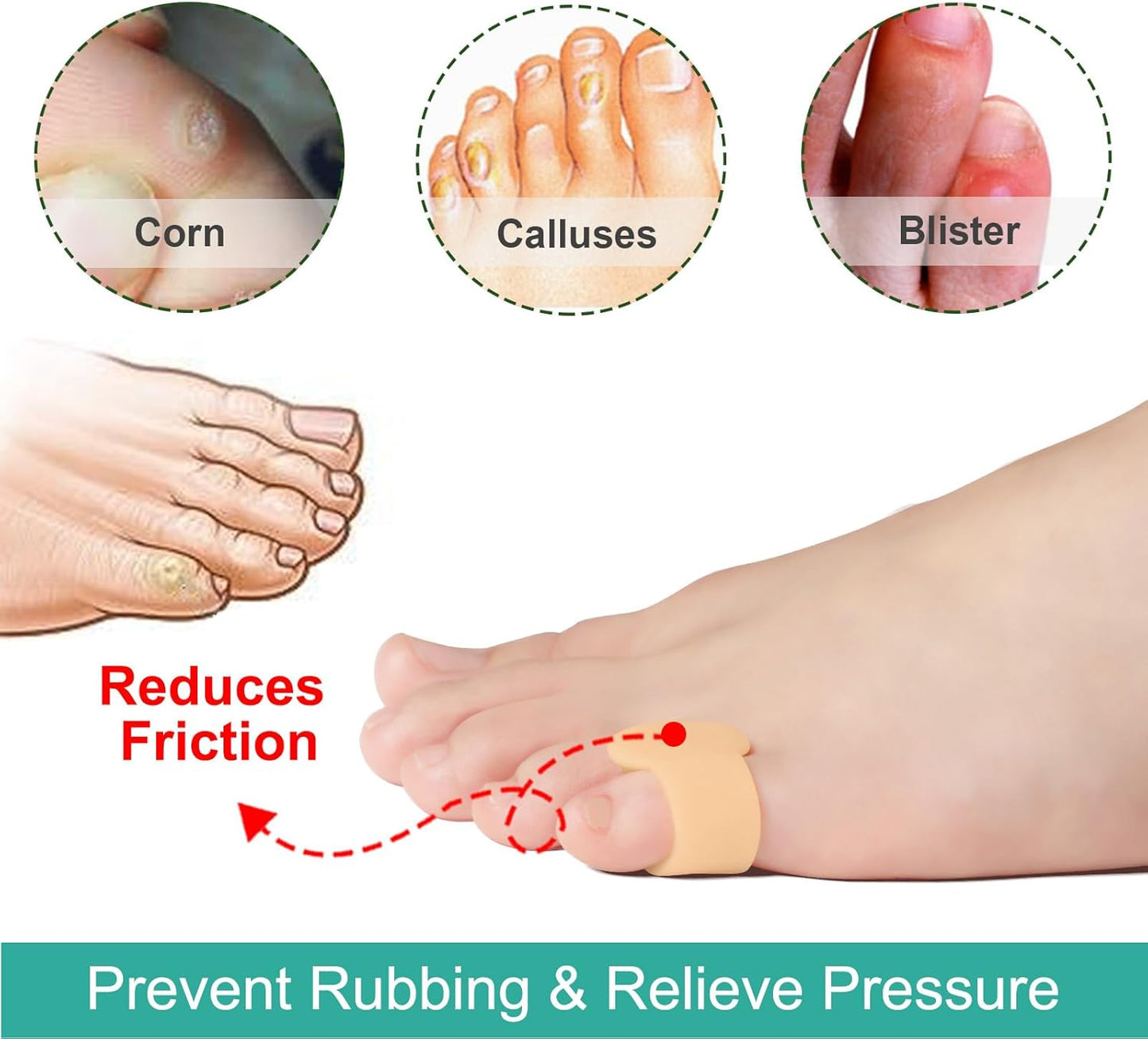 Welnove Gel Toe Separator - 8 Pack Pinky Toe Spacers - Little Toe Cushions, Small Sleeves for Preventing Rubbing & Reducing Pressure (Beige)