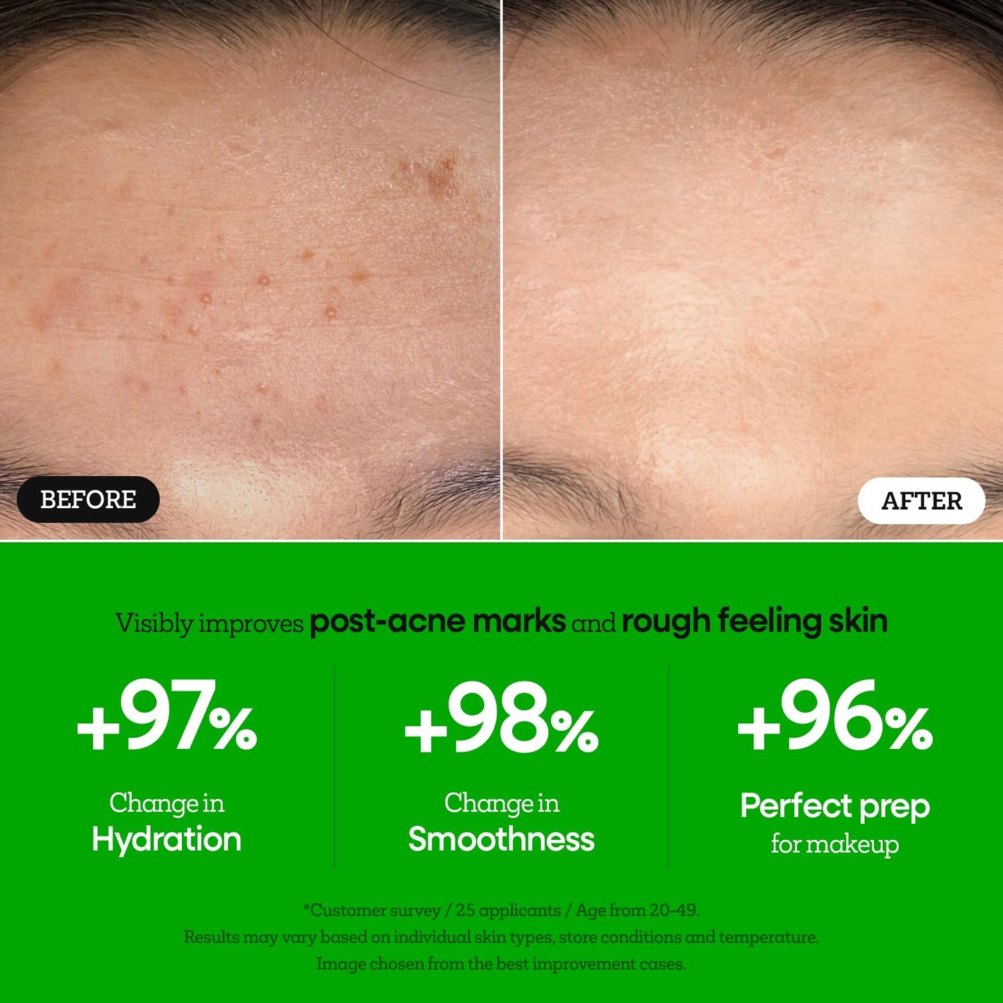 Nature Republic The First Peptide Boosting Serum – Niacinamide, Hyaluronic Acid, Hydrating & Firming Facial Serum, for Uneven Skin Tone, Korean Skincare, 150ml / 5.07 fl oz