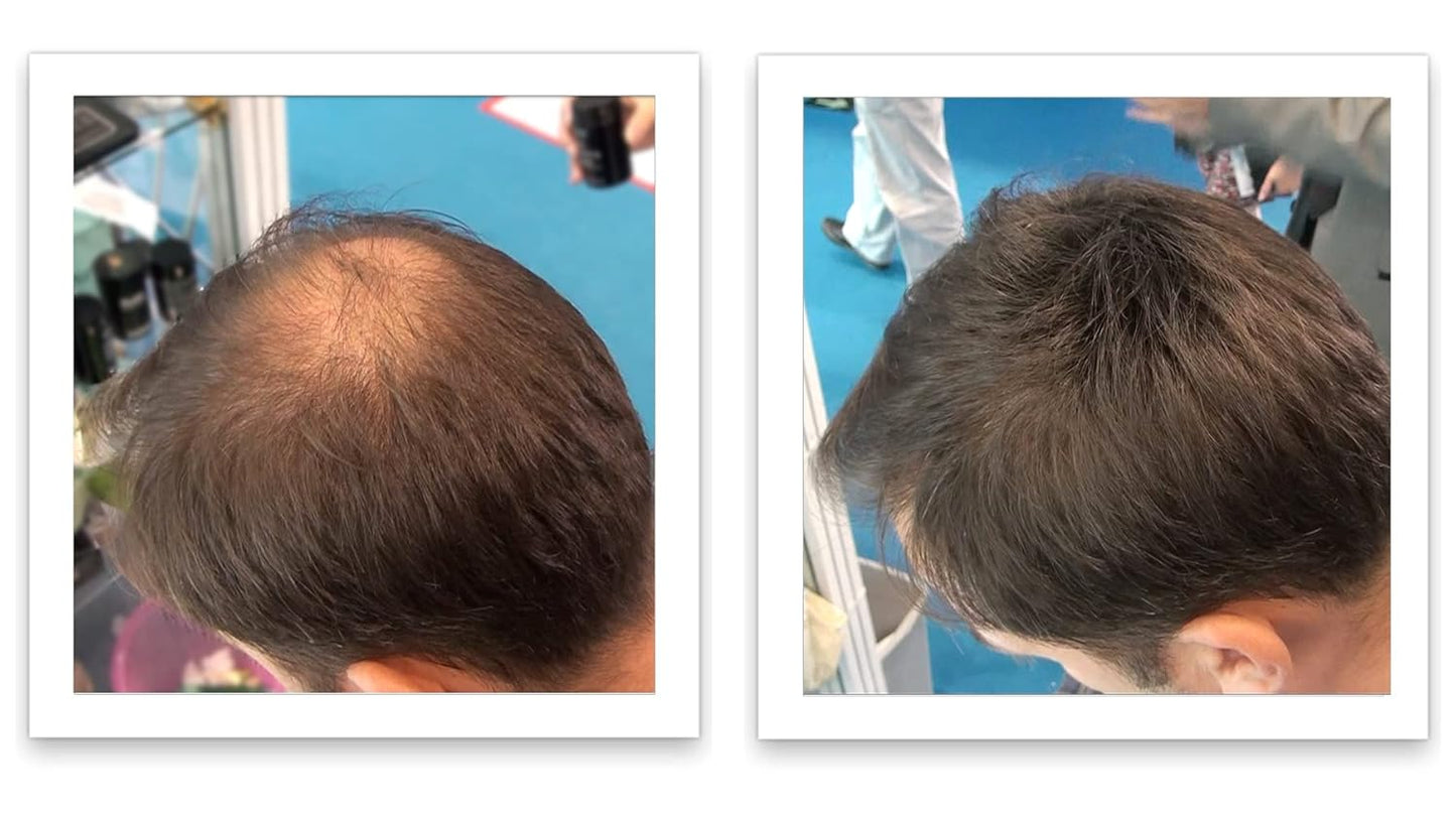 Caboki Hair Building Fiber + Built-in Spray Applicator (30-50 Days Supply). Medium Brown