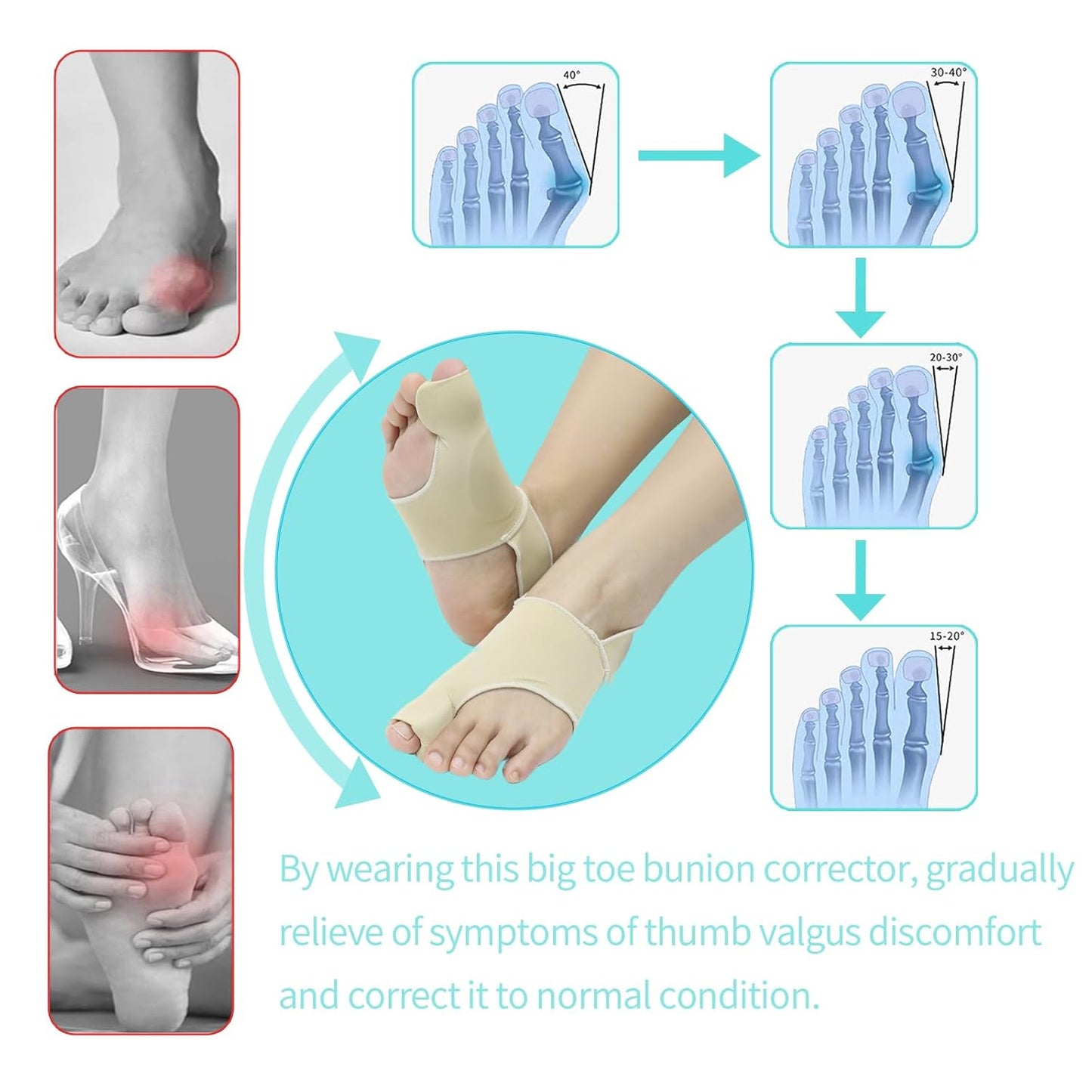 Bunion Relief Sleeves Bunion Pads Brace Cushions Toe Straightener with Silicone Gel Big Toe and Pinky Separator Spacer Hallux Valgus Relief Kit Pack (Small)