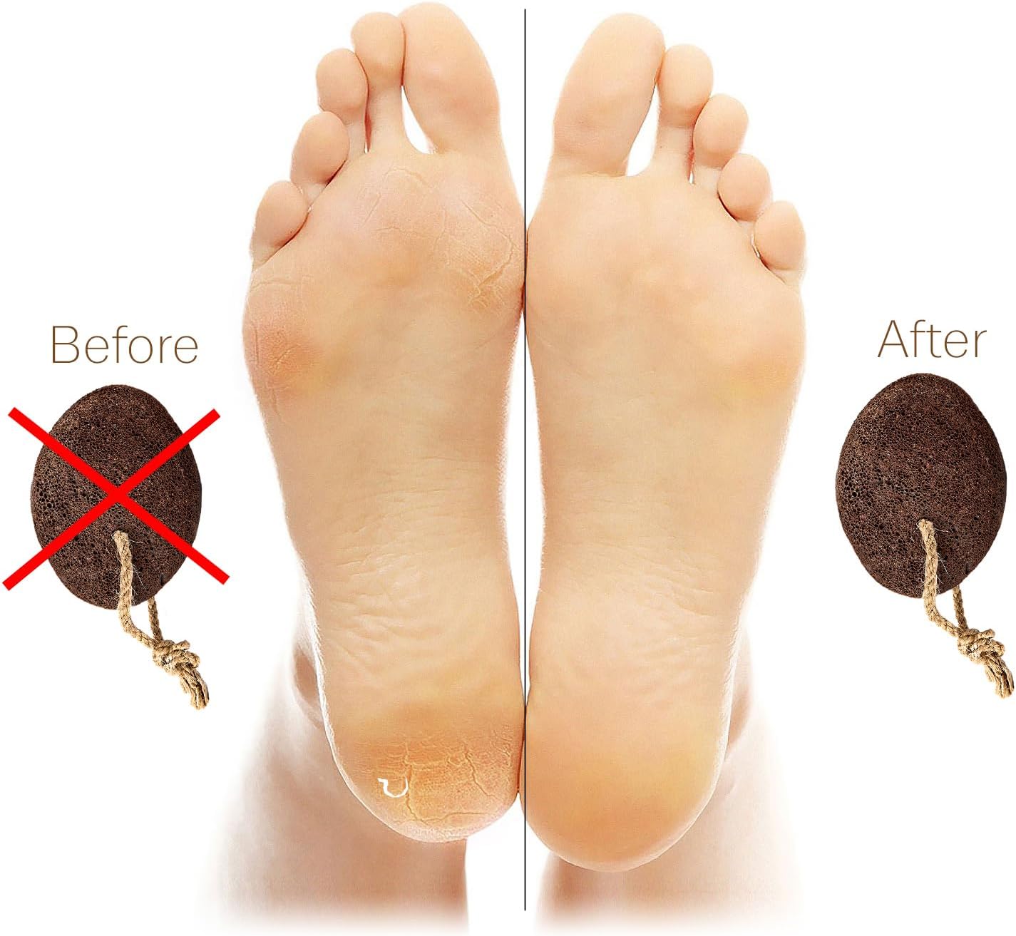 Pumice Stone - Natural Earth Lava Brown - Callus Corn Remover for Feet Heels and Palm - Pedicure Exfoliation Tool - Dry Dead Skin Scrubber - Health Foot Care