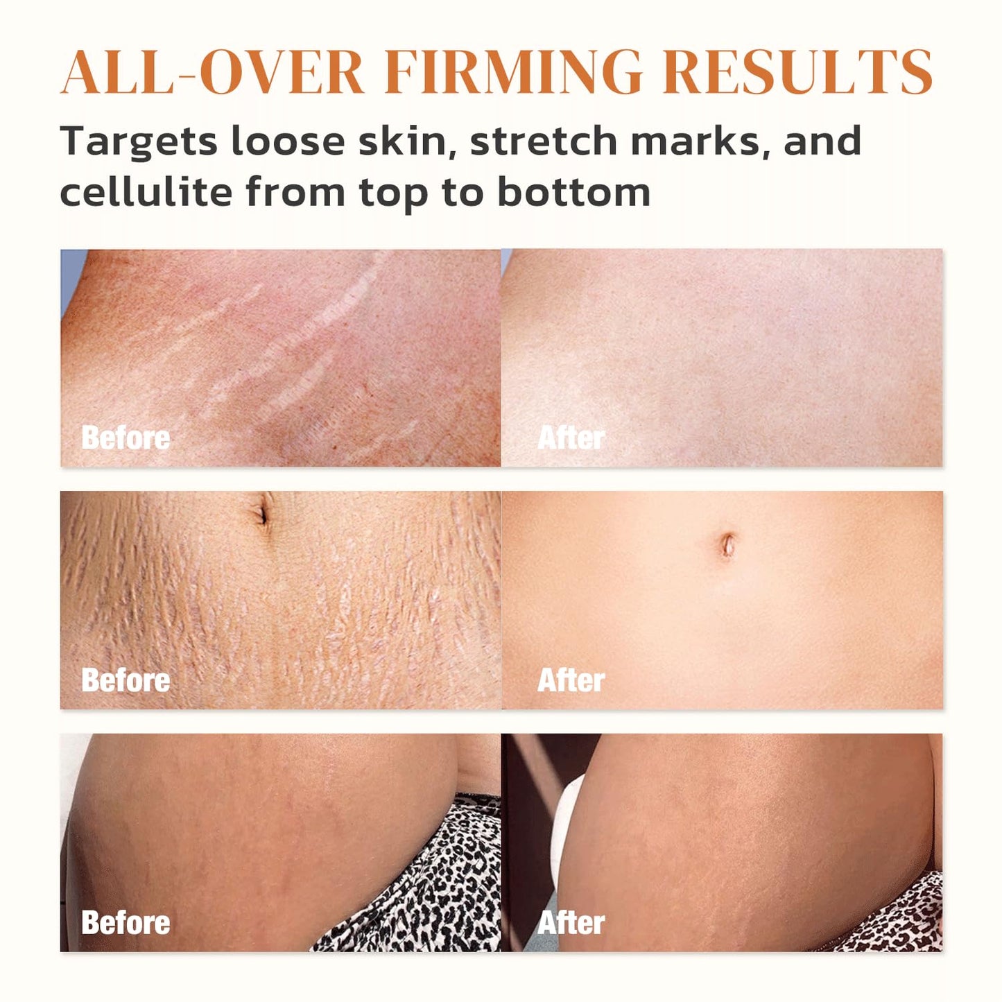 B Flat Belly Firming Cream – Skin Tightening Cream for Body: Lift & Tone Tummy, Thighs, Booty & Arms – Stretch Mark & Cellulite Sculpting Lotion for Women – 3.38 Fl Oz