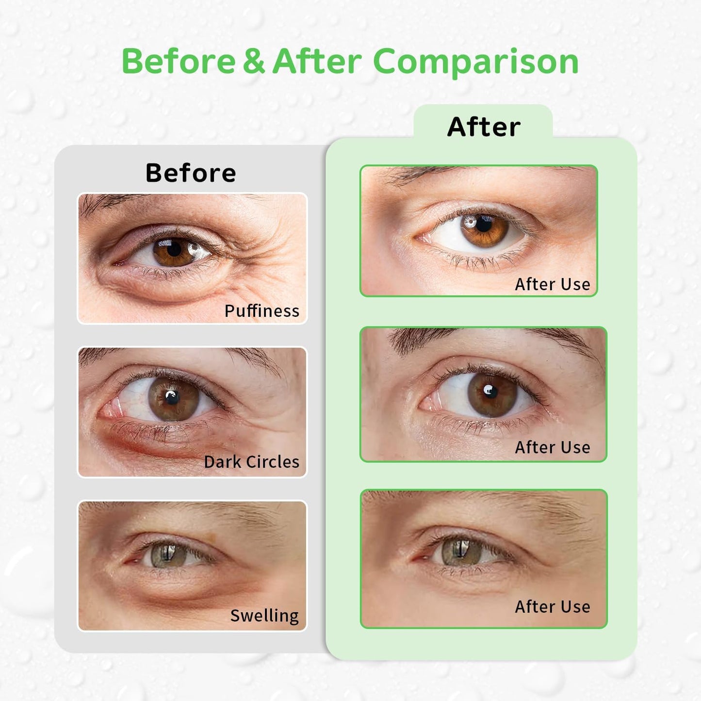 4PCS Gel Eye Ice Pack Set, Cold & Hot Compress, Reusable Cooling Gel Pads for Strain Relief, Relaxation, SPA and sleep(Green leaves)