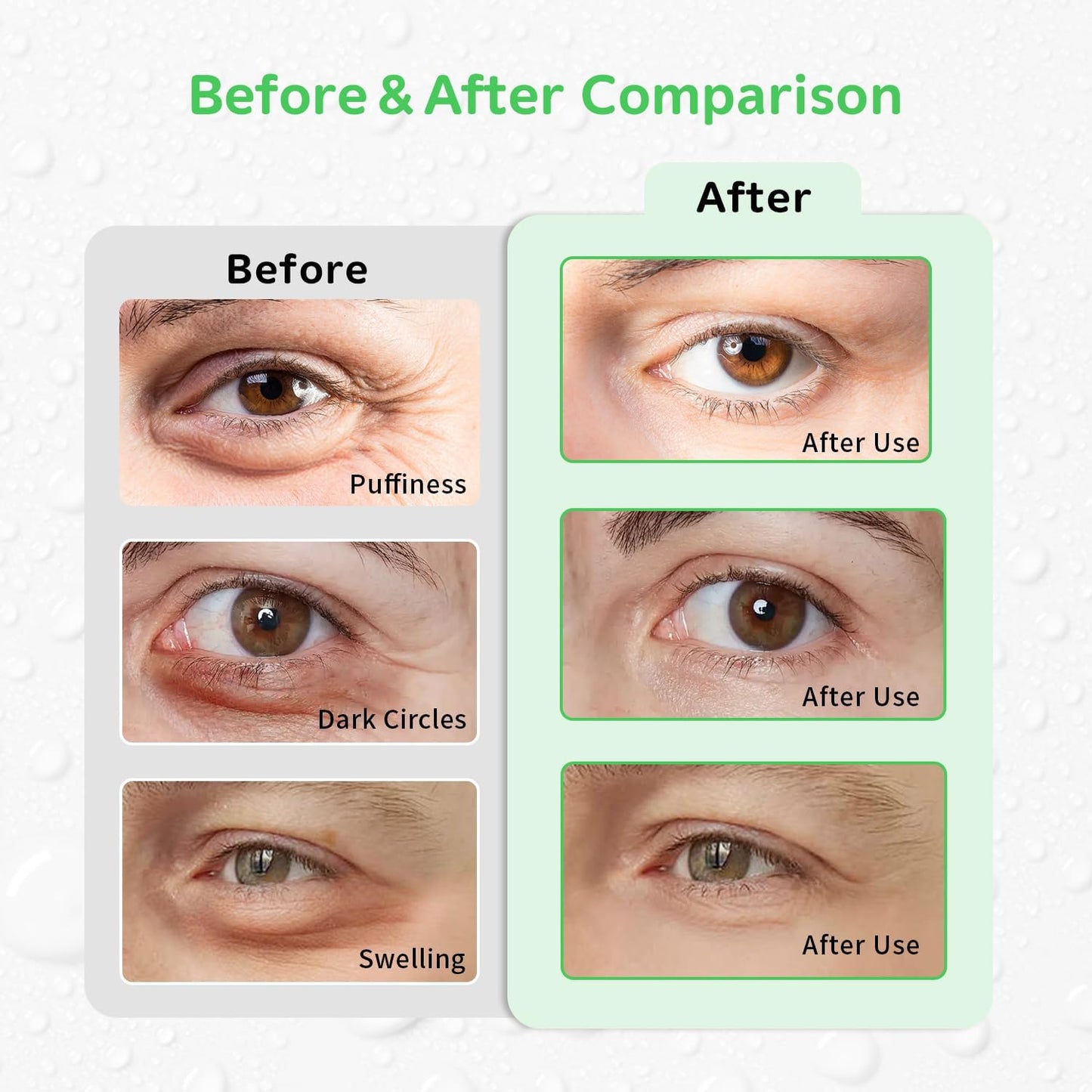 4PCS Gel Eye Ice Pack Set, Cold & Hot Compress, Reusable Cooling Gel Pads for Strain Relief, Relaxation, SPA and Sleep (4 Lemons)