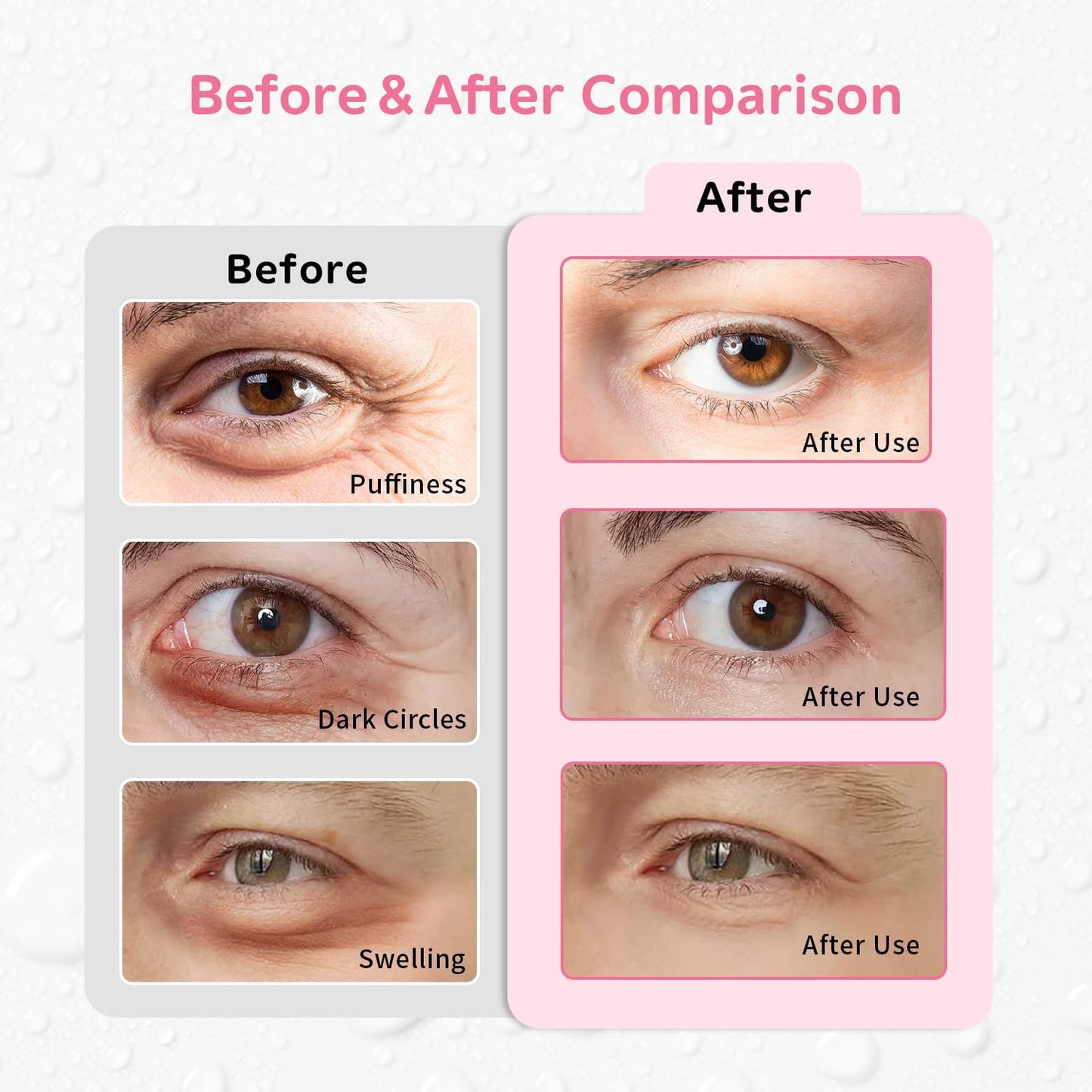 4PCS Gel Eye Ice Pack Set, Cold & Hot Compress, Reusable Cooling Gel Pads for Strain Relief, Relaxation, SPA and Sleep (4 Pink Flowers)