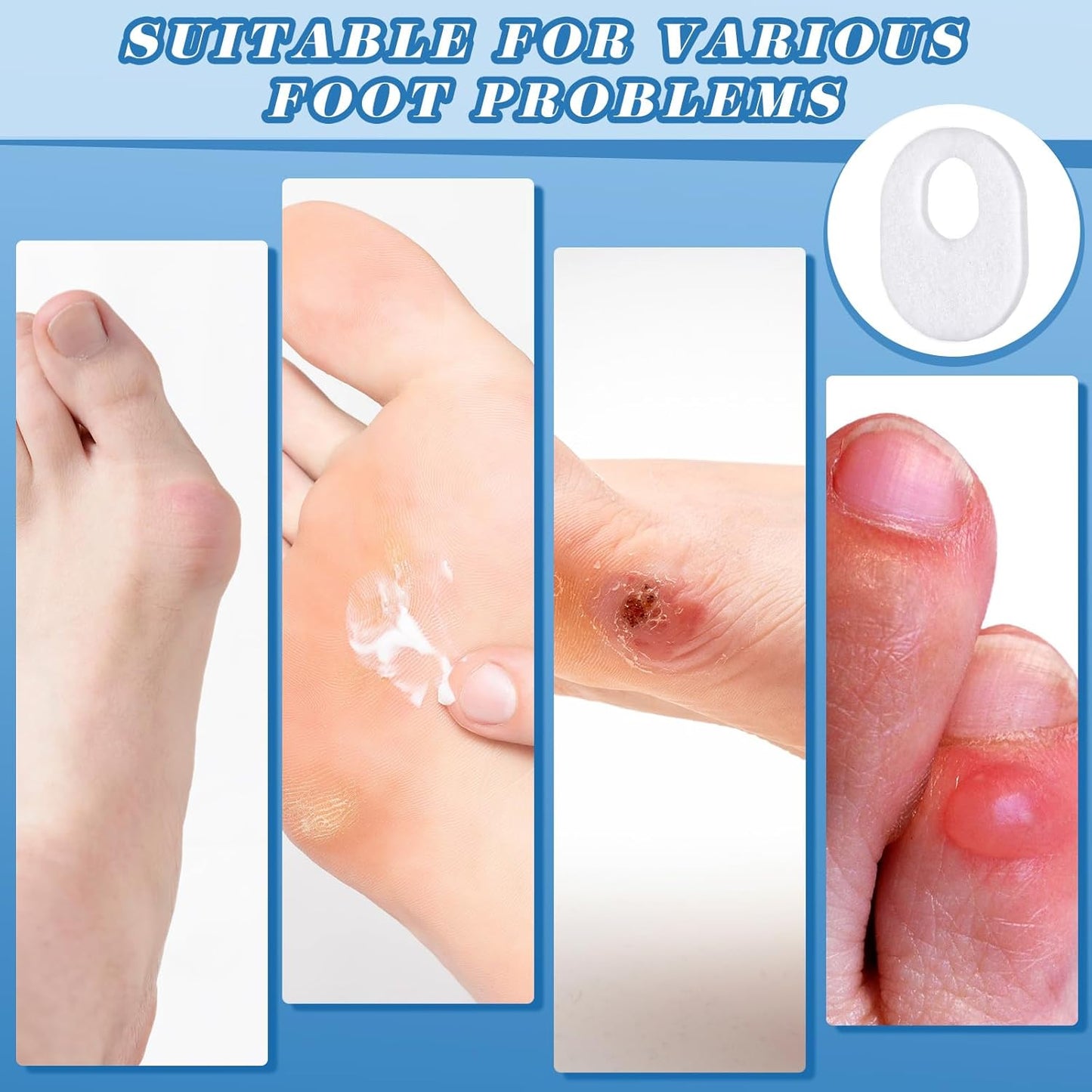 WILLBOND 120 Pcs Callus Pads Soft Felt Callus Oval Shape Corn Pads for Bottom of Foot Adhesive Foot Corn Cushion for Men and Women Feet Toes Heel Pain Relief (White)