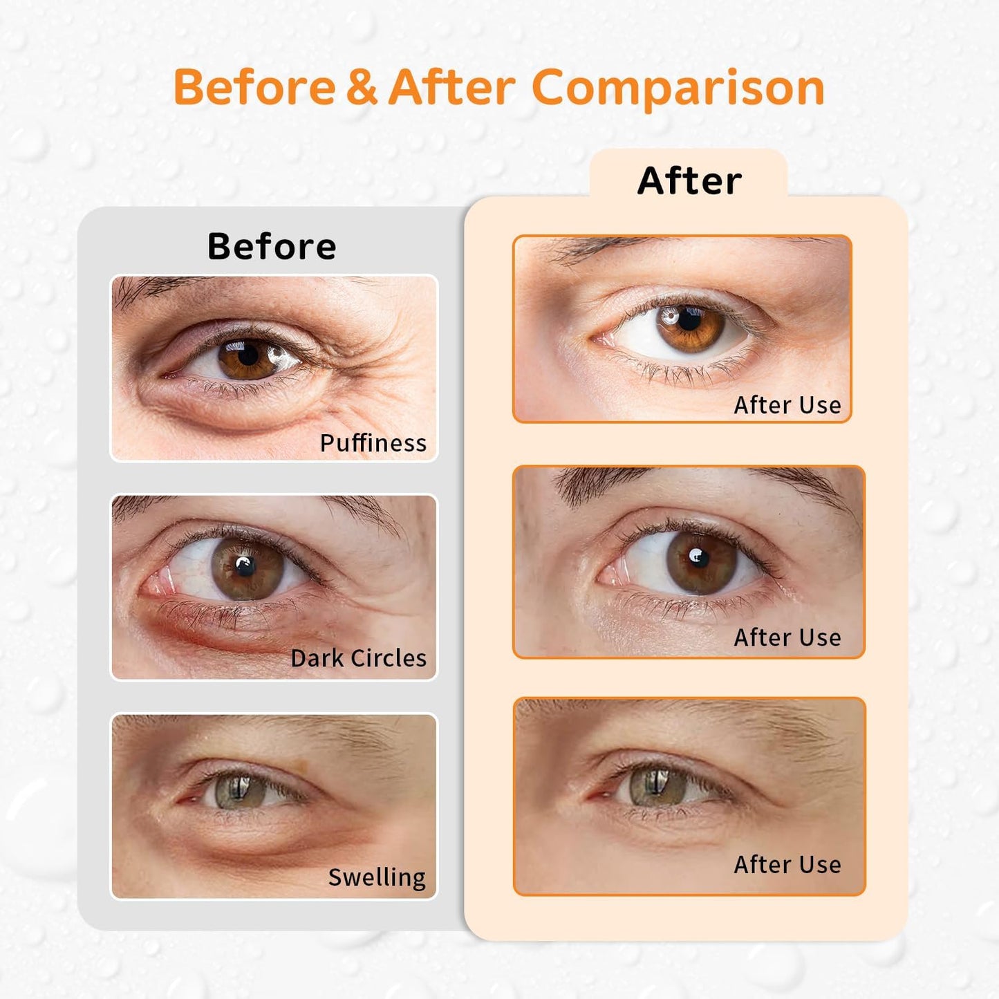 4PCS Gel Eye Ice Pack Set, Cold & Hot Compress, Reusable Cooling Gel Pads for Strain Relief, Relaxation, SPA and Sleep (4 Orange Flowers)