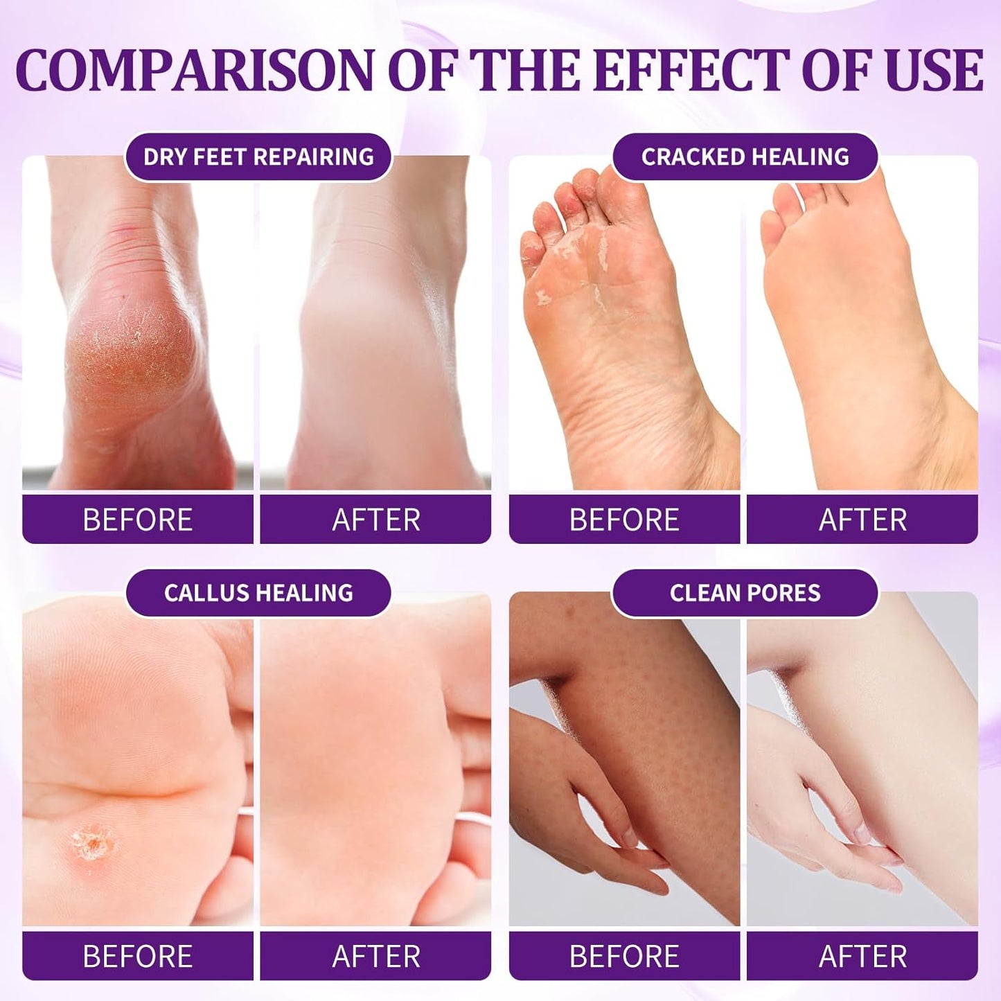 Pedicure Kit Foot Soak Set: Bubble Salt, Sugar Scrub, Massage Mask, Massage Lotion in a Box, 4 Step Foot Spa Kit for Dry Feet,Tired Feet（1 Set Lavender)