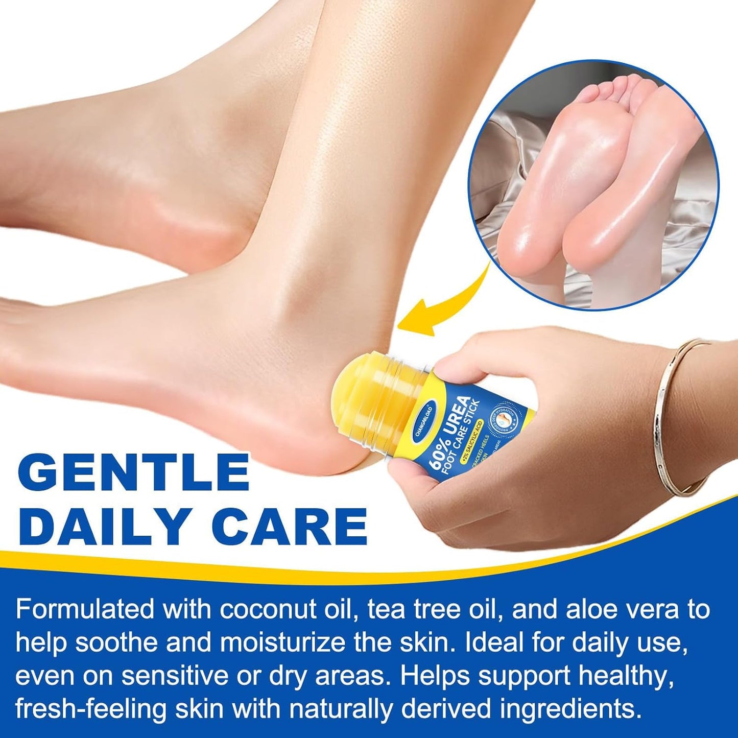 60% Urea + 2% Salicylic Acid Foot Cream–Ultra-Moisturizing Formula, Exfoliates Dead Skin, Softens Dry, Cracked Skin on Feet, Knees, Hands, Elbows. Helps soften callused, rough, or tender areas 2.82oz