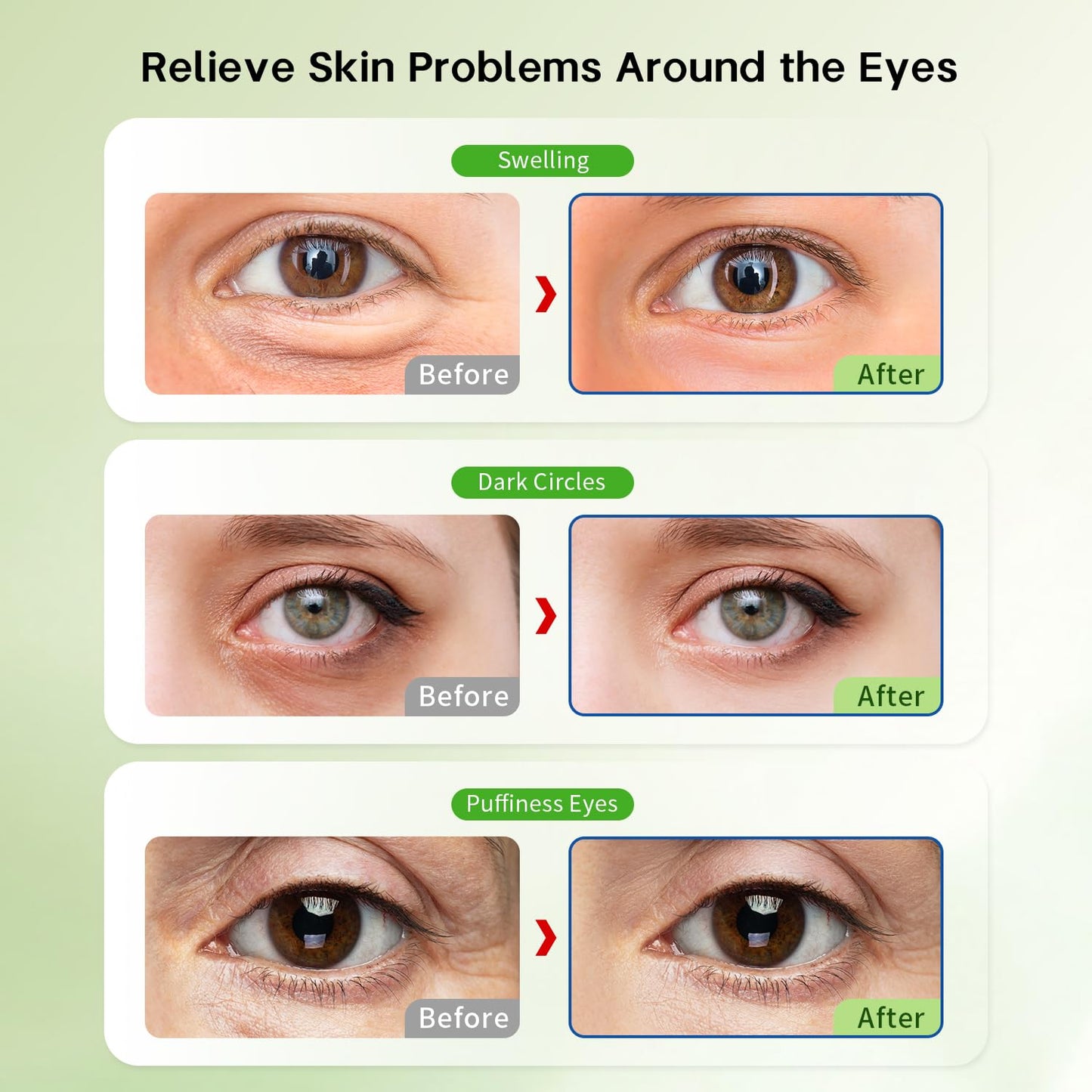 ZNÖCUETÖD Reusable Gel Eye Pads for Puffiness & Dark Circles - Cold/Warm Therapy Compress with Cooling Under Eye Patches, Reduces Wrinkles & Redness, Pain Relief Eye Mask for Relaxation