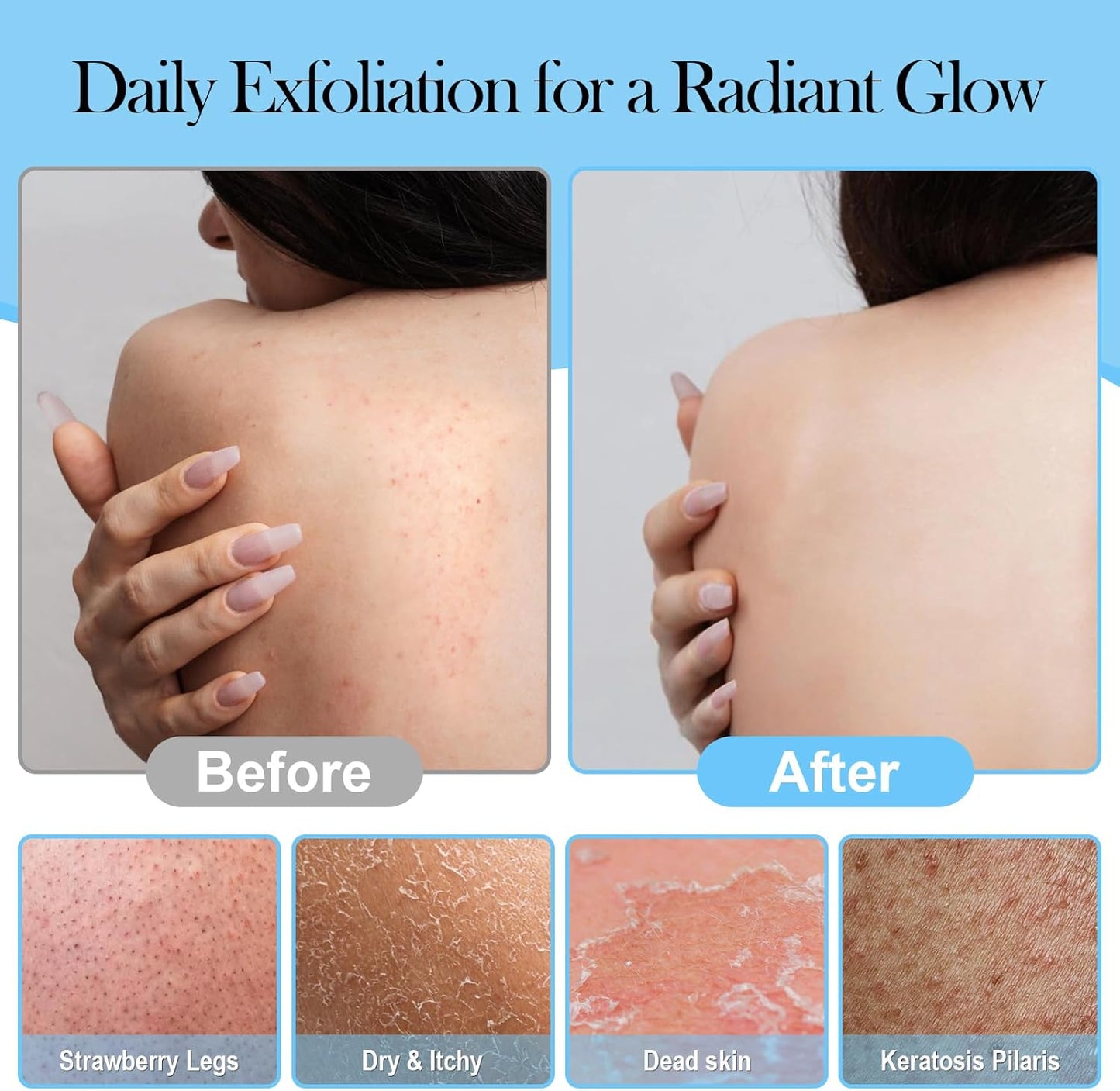 ‌Dual-Function Exfoliating Glove for Shower- Body Scrubber & Shower Loofah 2-in-1 - Korean Exfoliating Mitt for Smooth Skin - Remover Dead Skin and Keratosis - Blue (1-Pack)