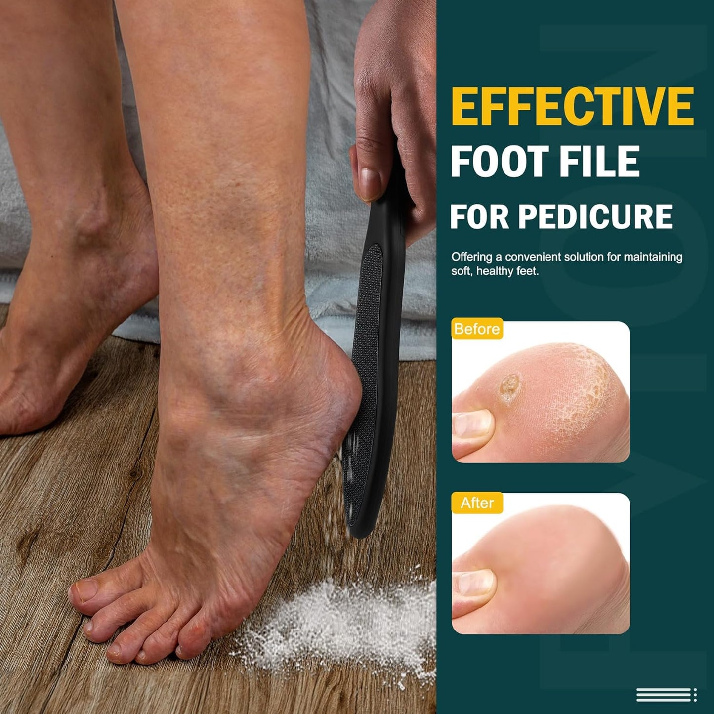 FVION Double-Sided Nano Glass Foot File for Callus Remover - Highly Effective Hard and Dead Skin Remover for Cracked Heels and Dry Skin (Black)