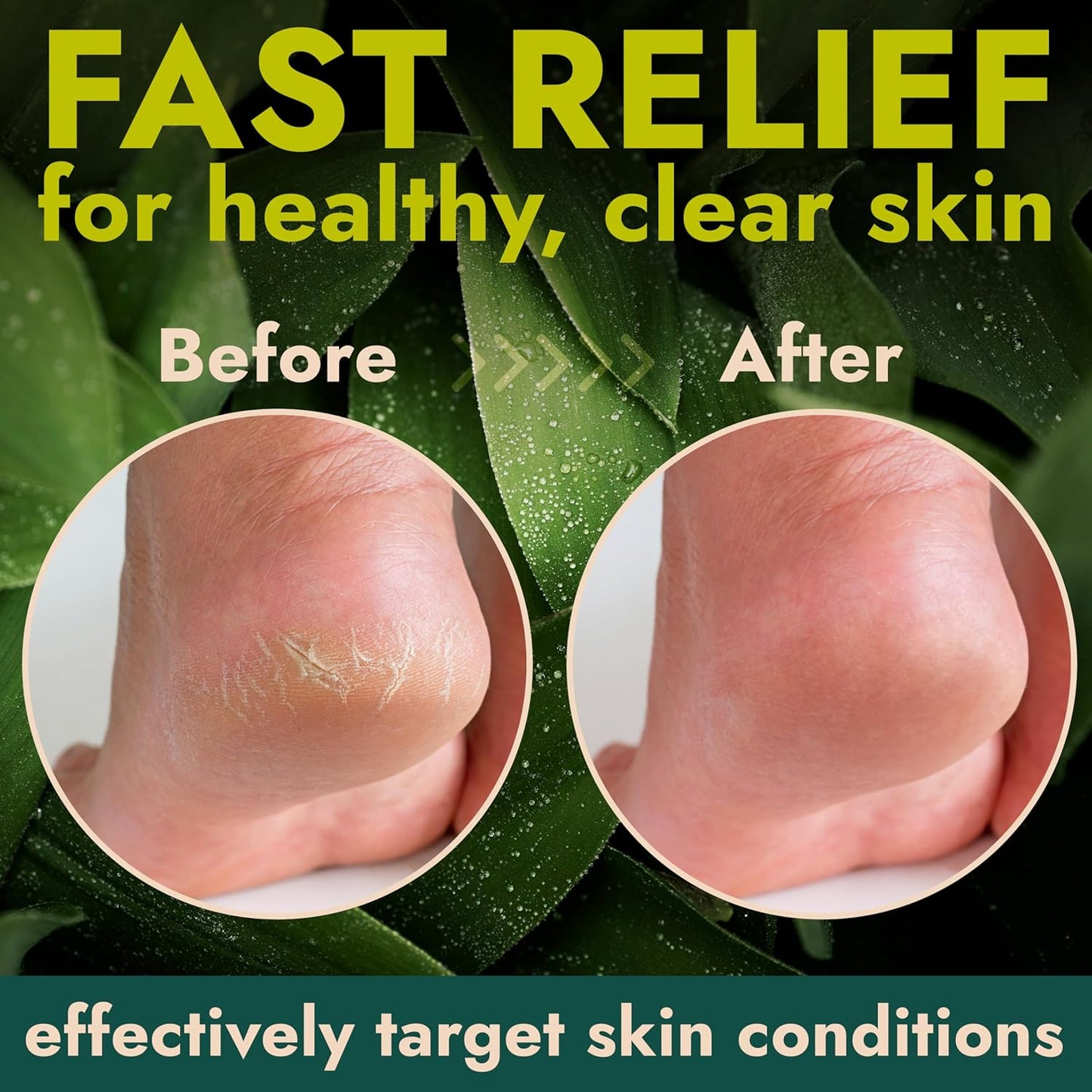 Foot Balm for Dry Cracked Feet | Foot Balm Stick for Dry Cracked Feet Tough Skin on The Heels and Intensely Moisturizing | No Mess Applicator | 2 Pack Stick