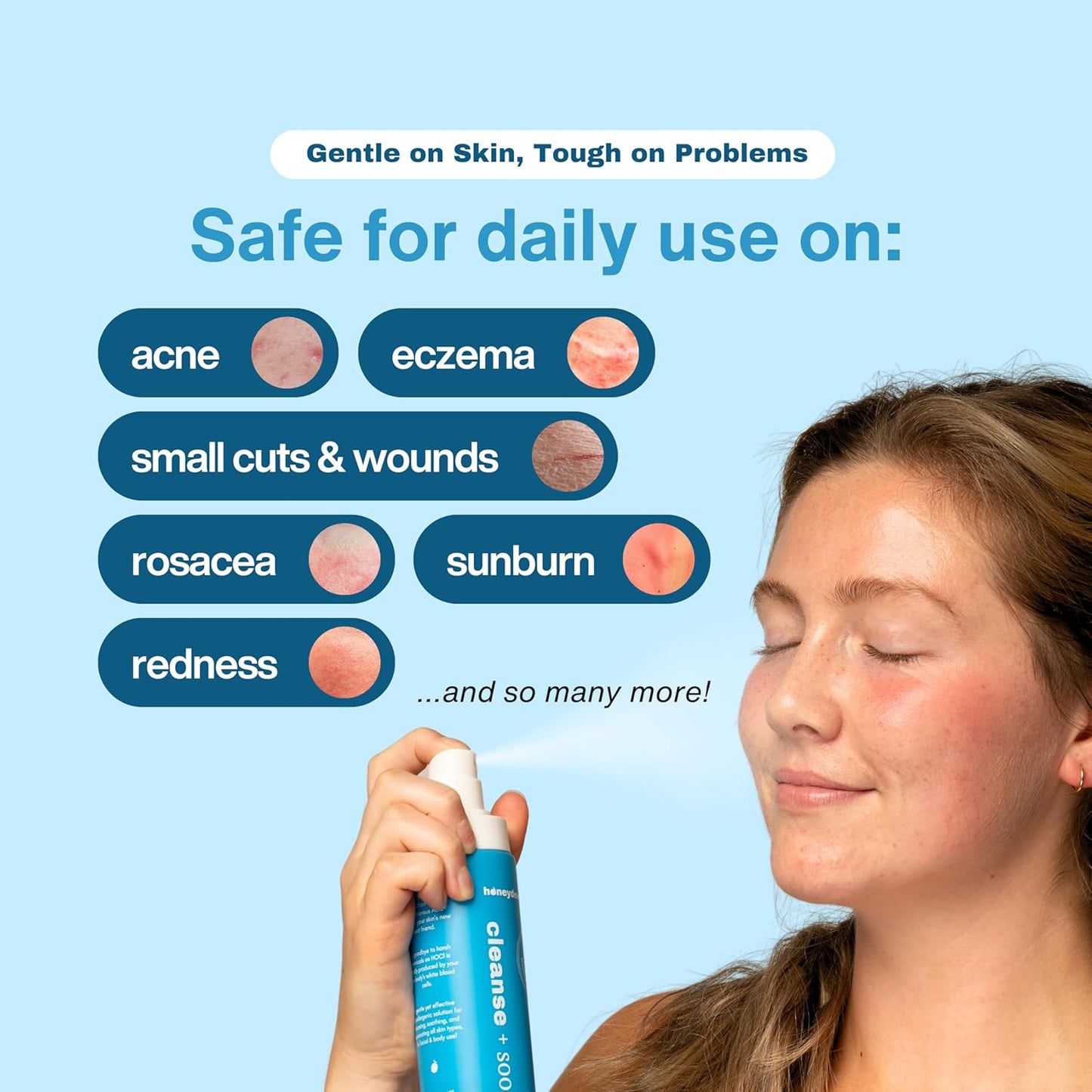 Honeydew Labs - Hypochlorous Acid Spray - HOCL - Hypoallergenic Skin Toner Cleanse and Soothe Sensitive Face - Acne - Eczema - Bacne - Eyelid - Pre Post Workout (Mini Bundle Pack - 2fl + 2 fl)