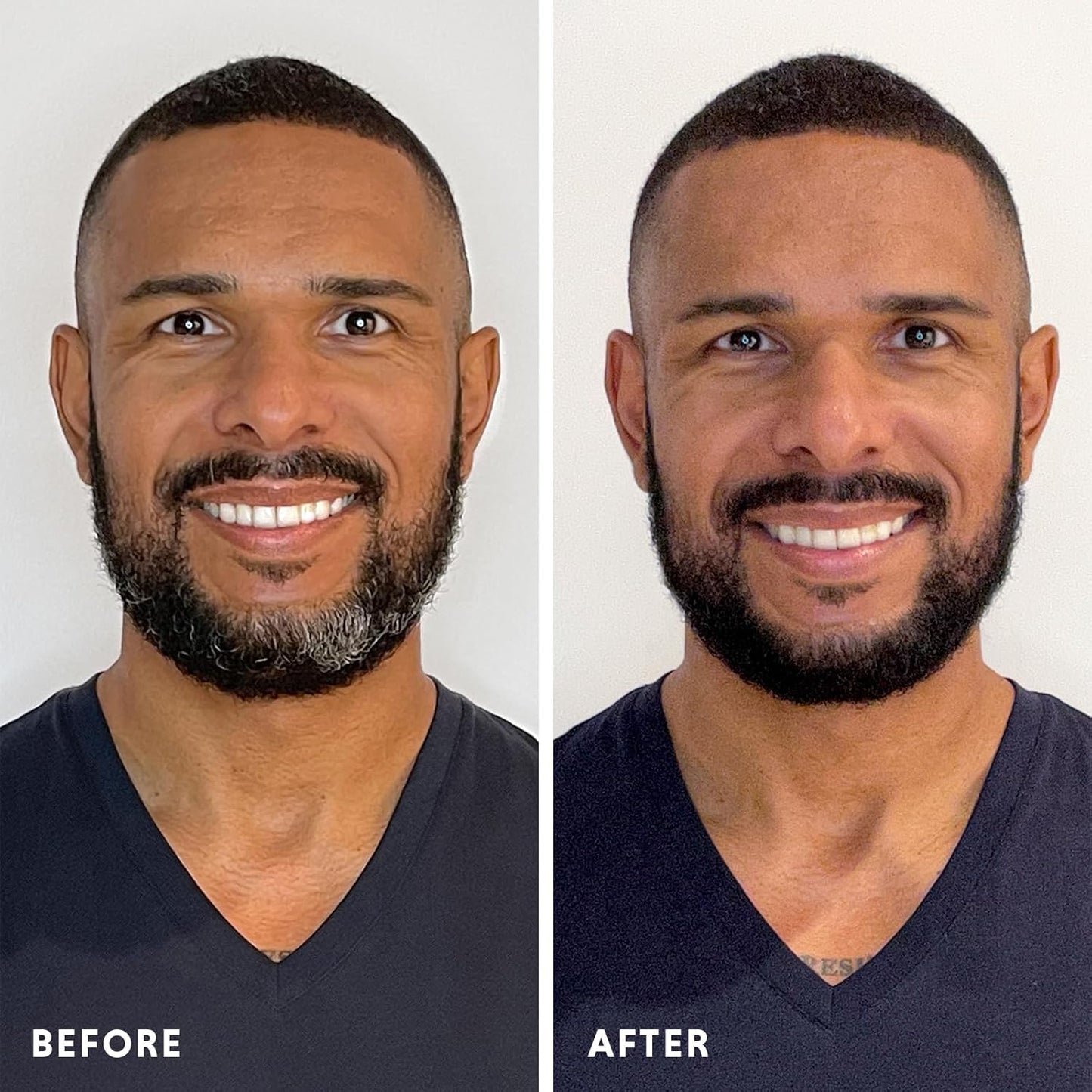 Hair & Beard Color for Full Gray Coverage 2 pack - Dark Brown - Ammonia-Free Complete Men’s At-home Beard & Hair Dye Kit, Professional-grade Permanent Hair Color (4.0)