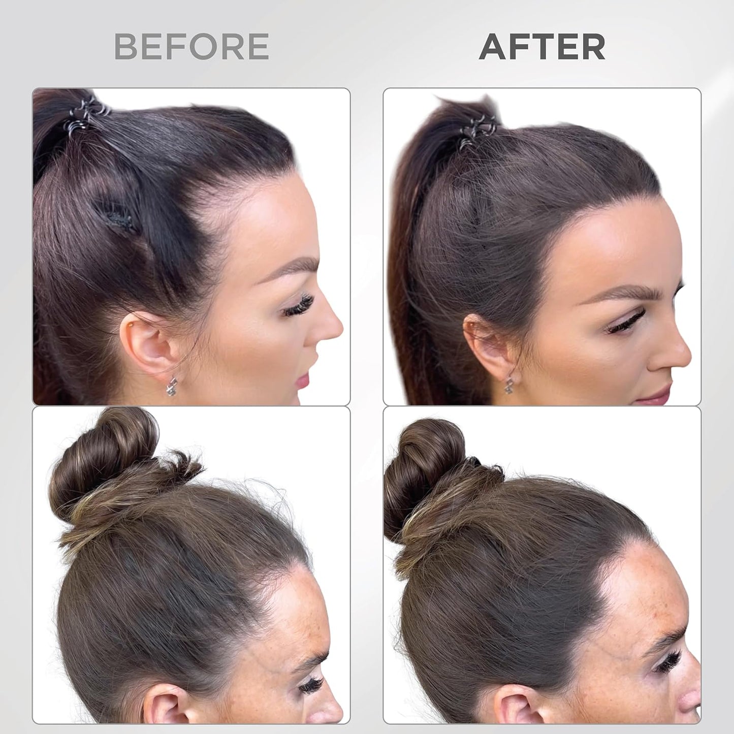 THICK FIBER Root Touch Up & Hairline Powder with Brush (LARGE 10g) – Covers Grey Roots, Thinning Hair & Bald Spots – Sweat & Water Resistant Hair Concealer for Women & Men (Dark Brown)