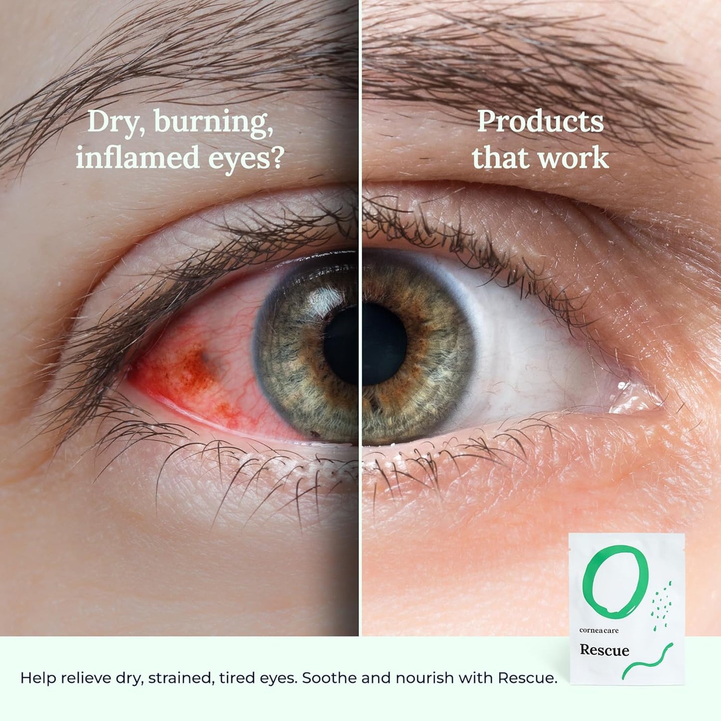 CorneaCare Rescue: Hydrogel Self Cooling Compress | Cold Eye Masks for Puffy Eyes | Self Cooling Eye Compress for Fast Relief | Travel Ready | 6 Count